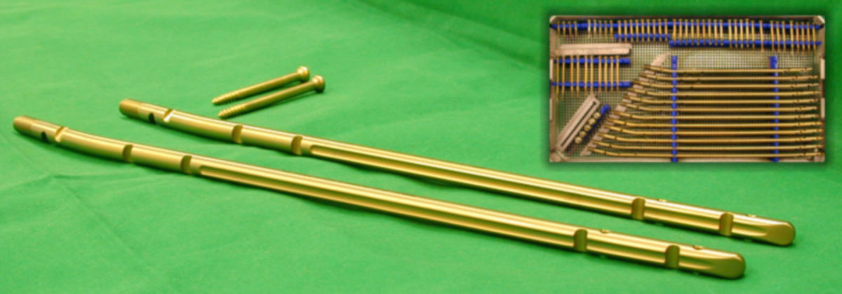 Tibianägel mit Verriegelungsschrauben aus Titan