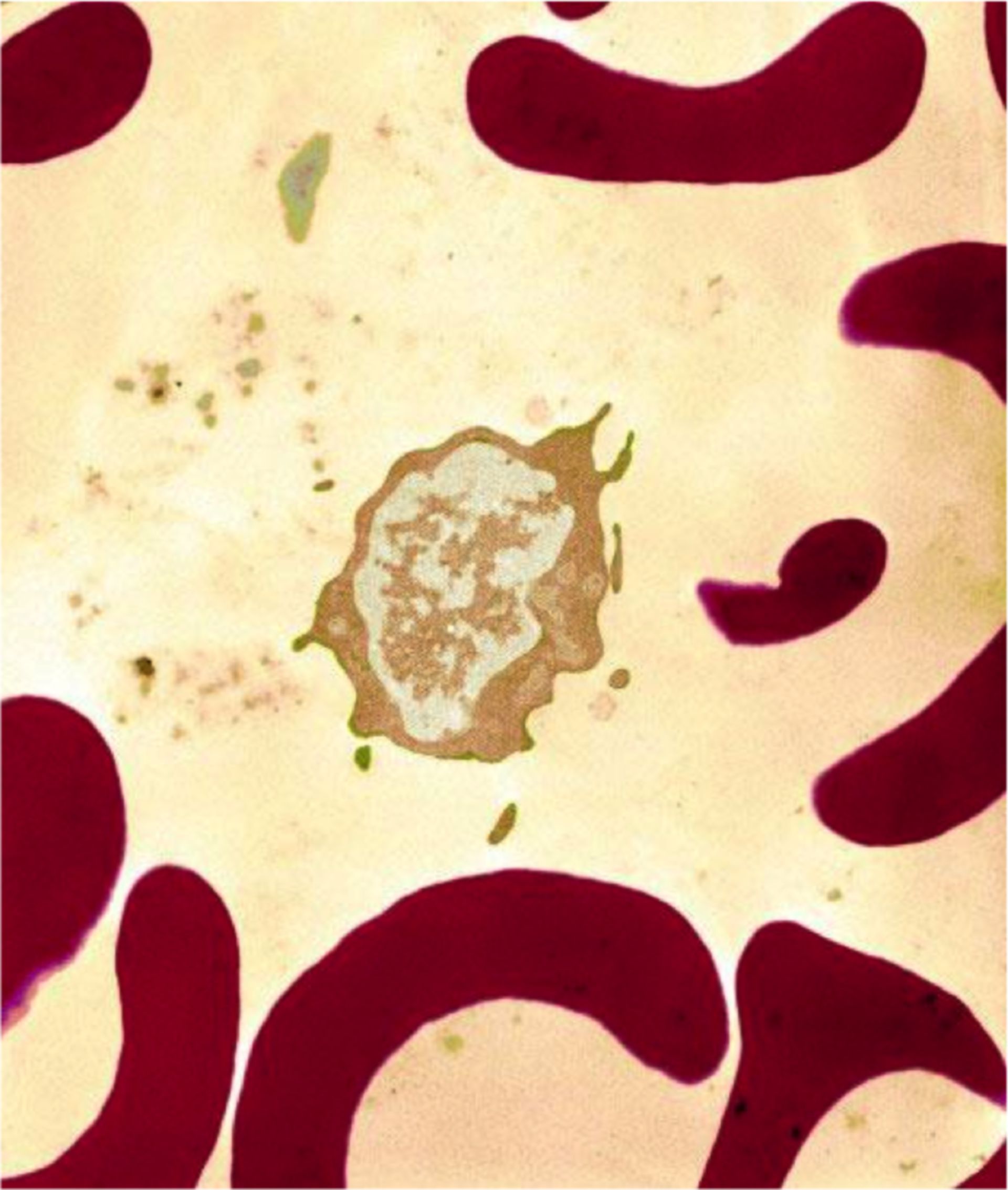 Blut: Weiße und rote Blutkörperchen