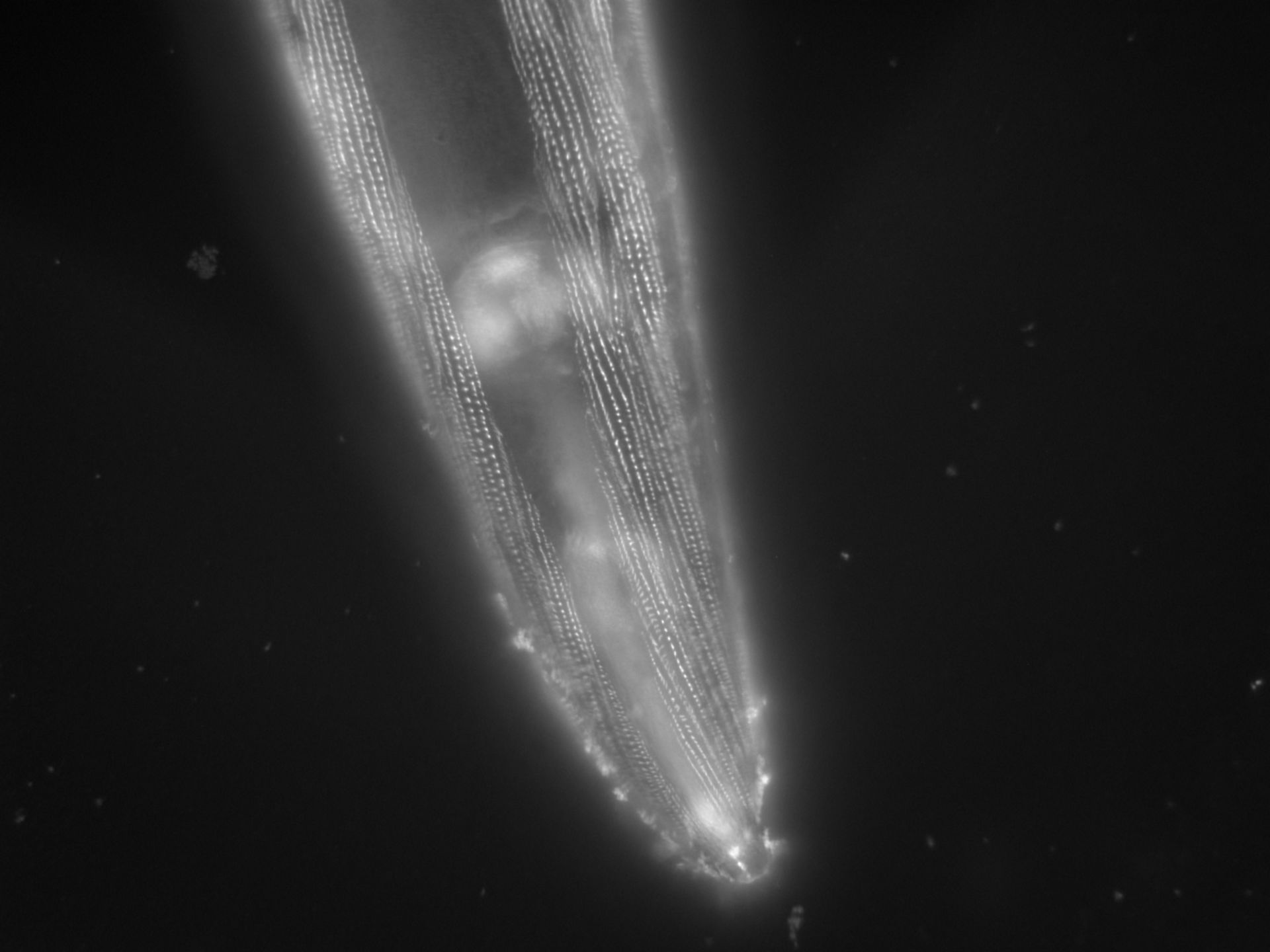 Caenorhabditis elegans (Actin filament) - CIL:1139