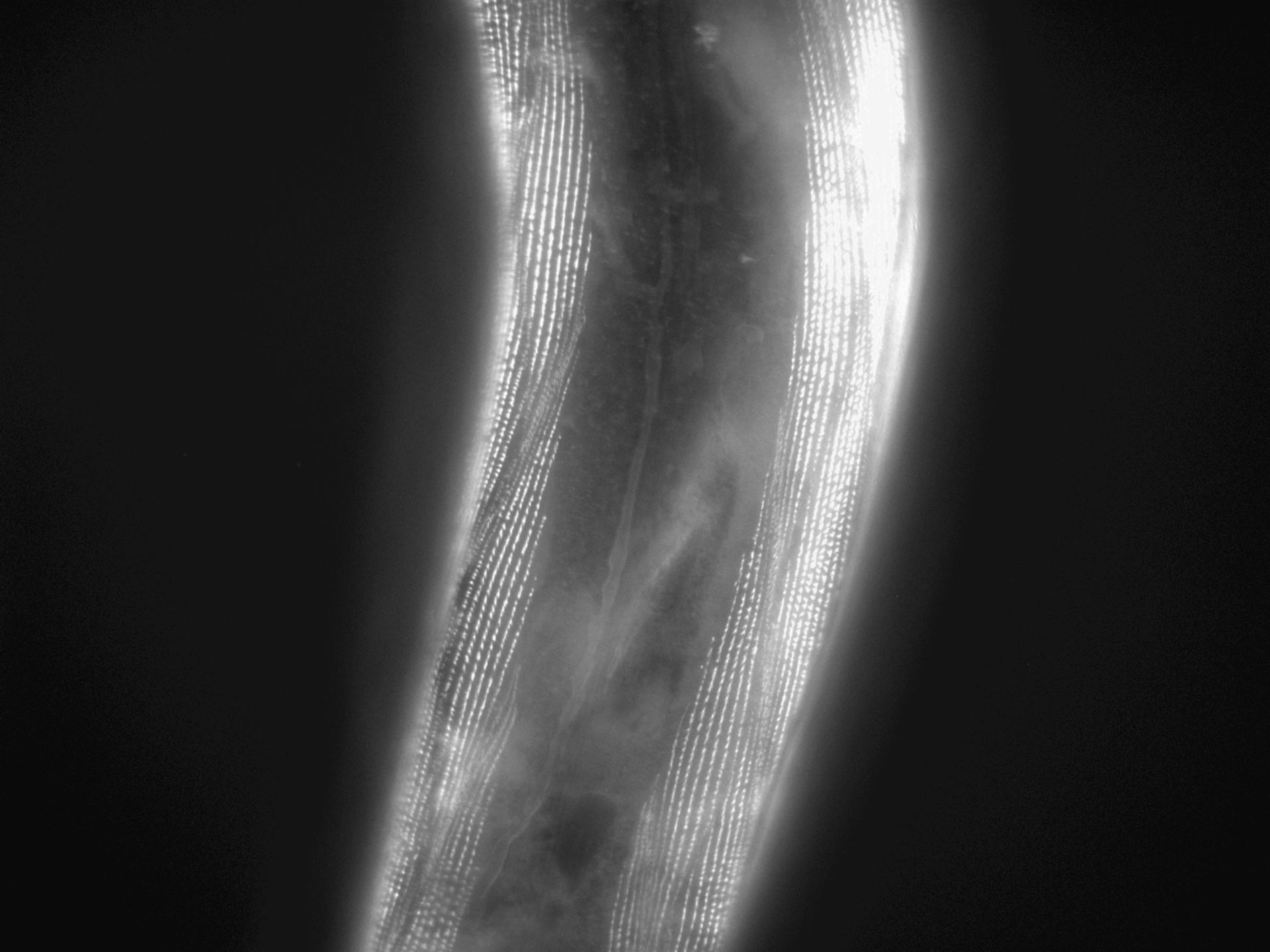 Caenorhabditis elegans (Actin filament) - CIL:1185