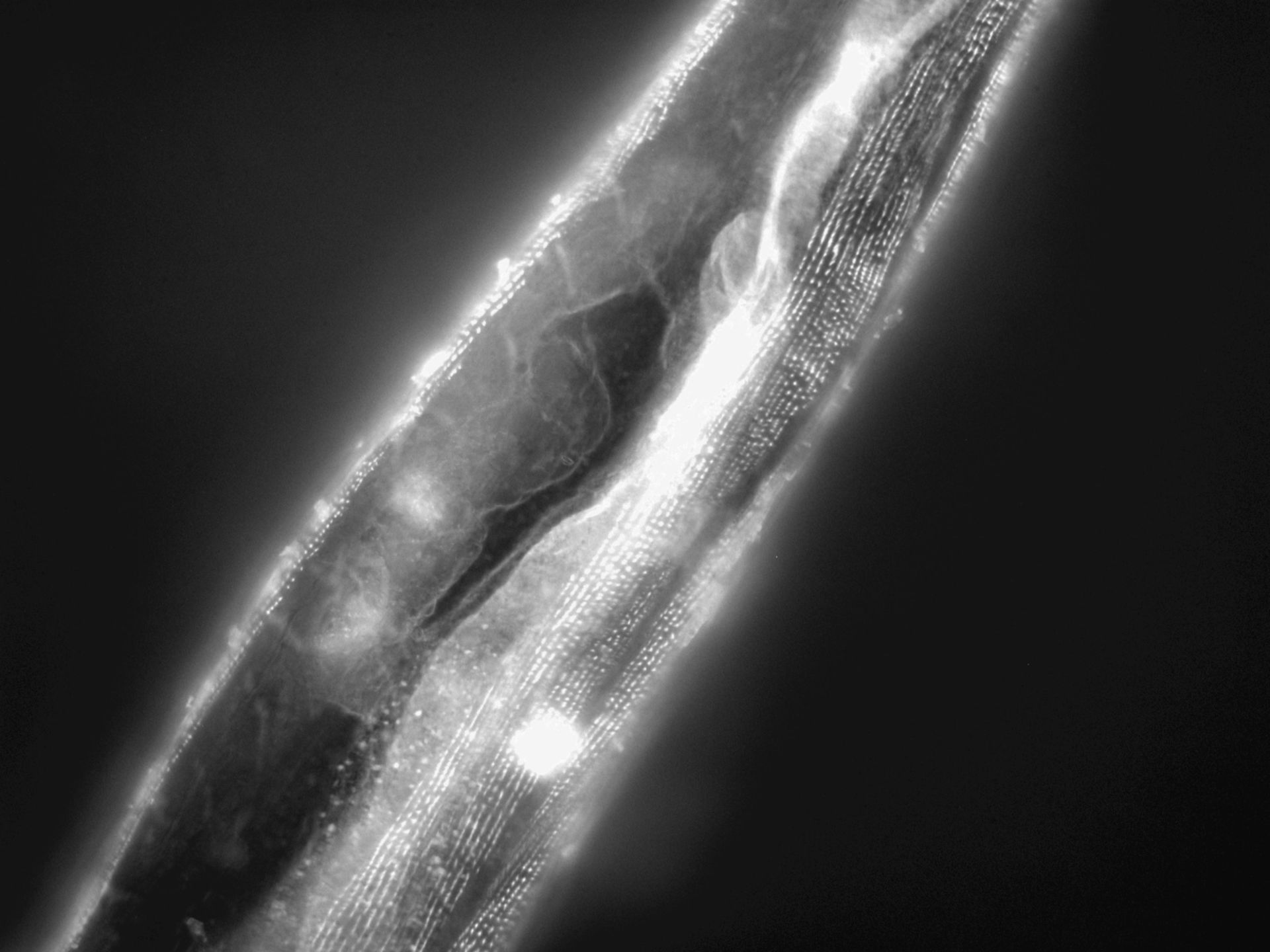 Caenorhabditis elegans (Actin filament) - CIL:1150