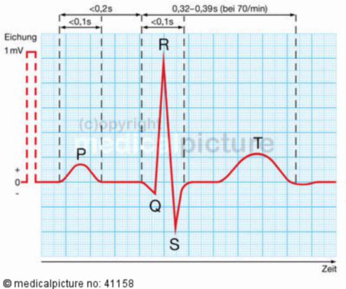 Elektrokardiogramm, EKG-Kurve