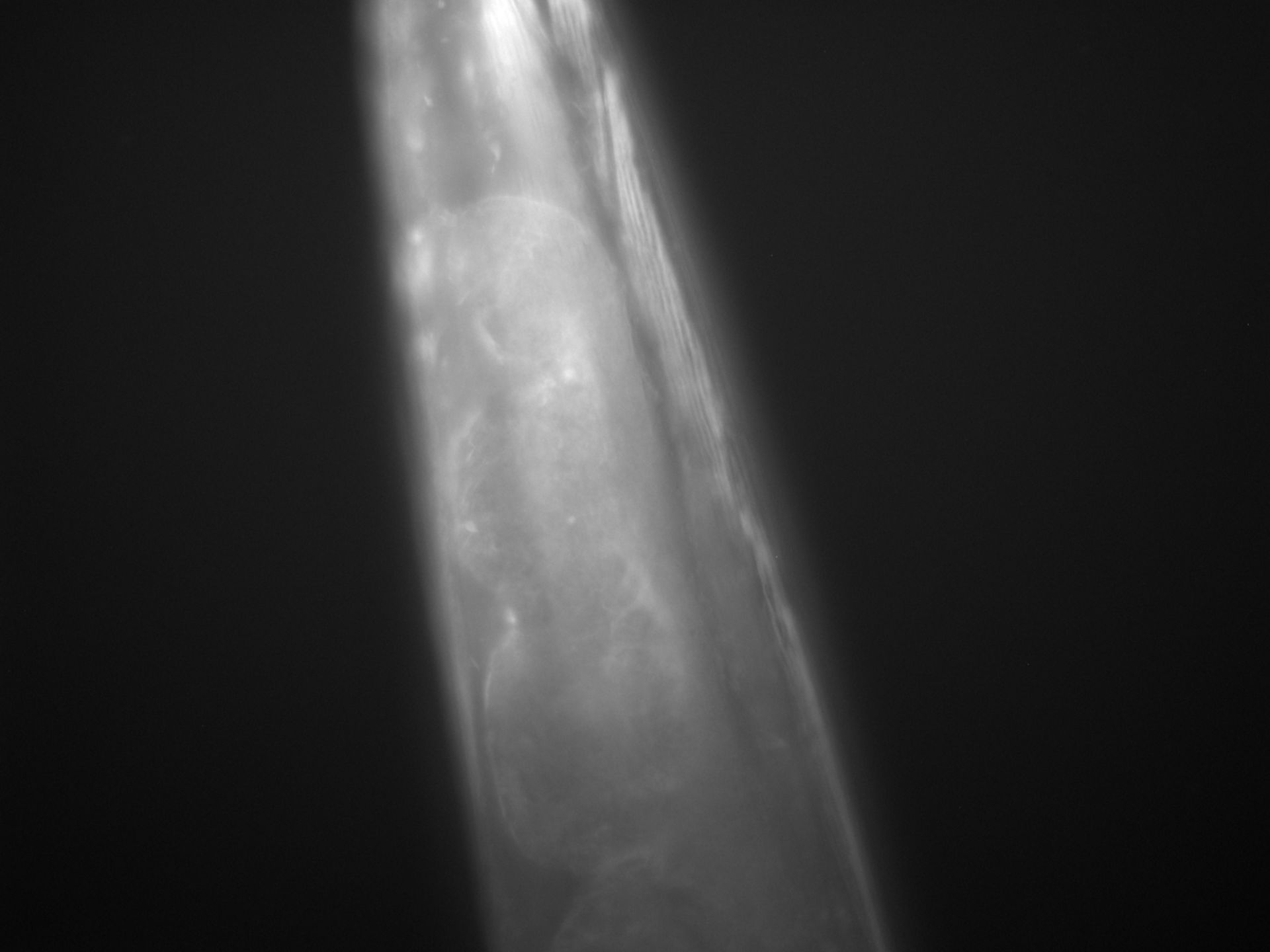 Caenorhabditis elegans (Actin filament) - CIL:1267