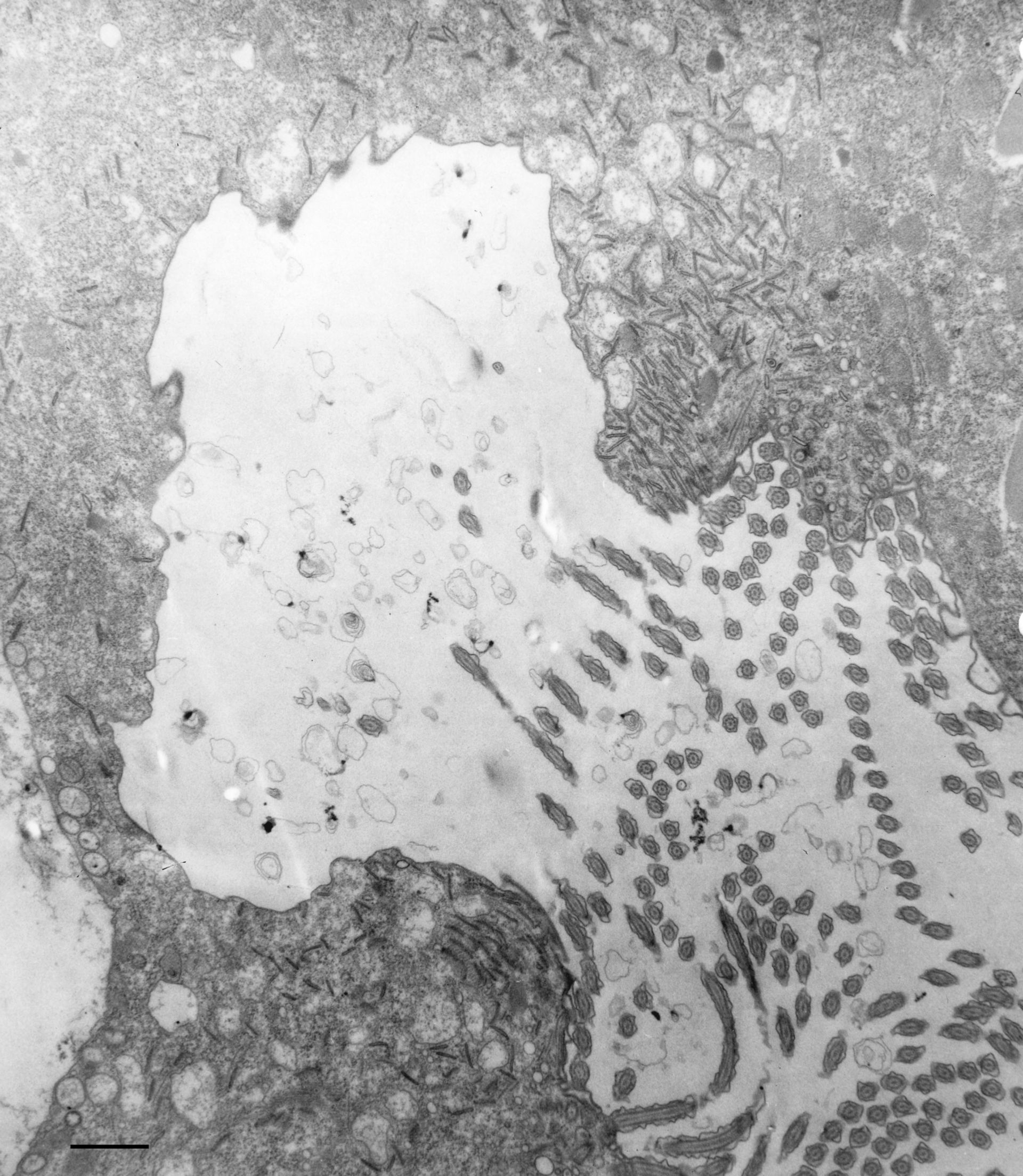 Paramecium multimicronucleatum (Food vacuole) - CIL:36696