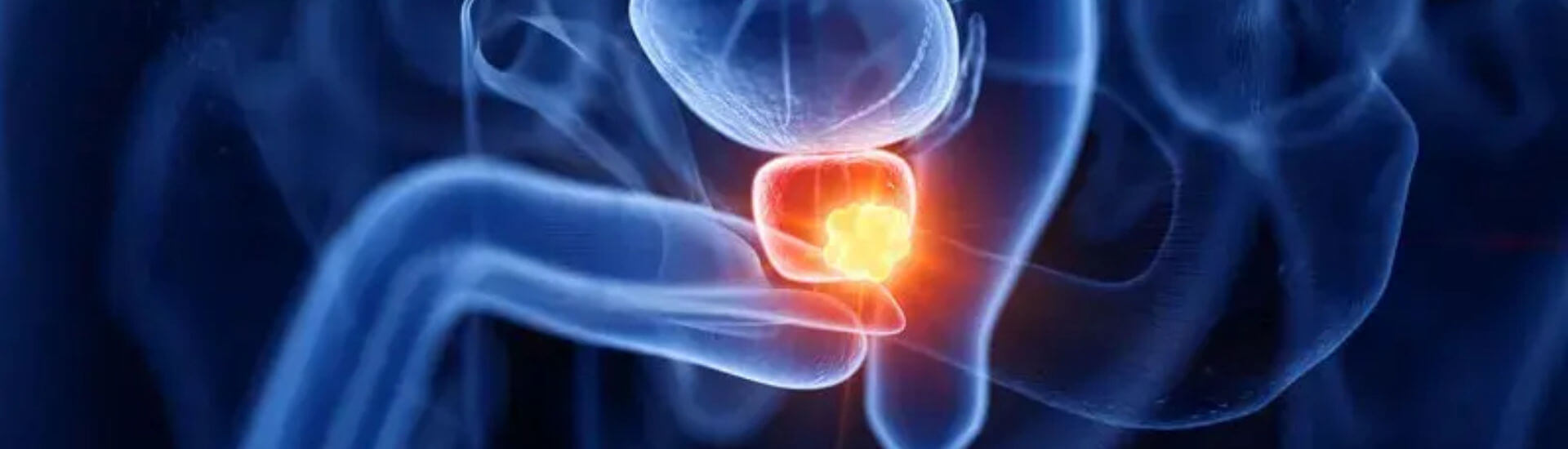 Neueinf hrung orgovyx bei prostatakarzinom doccheck