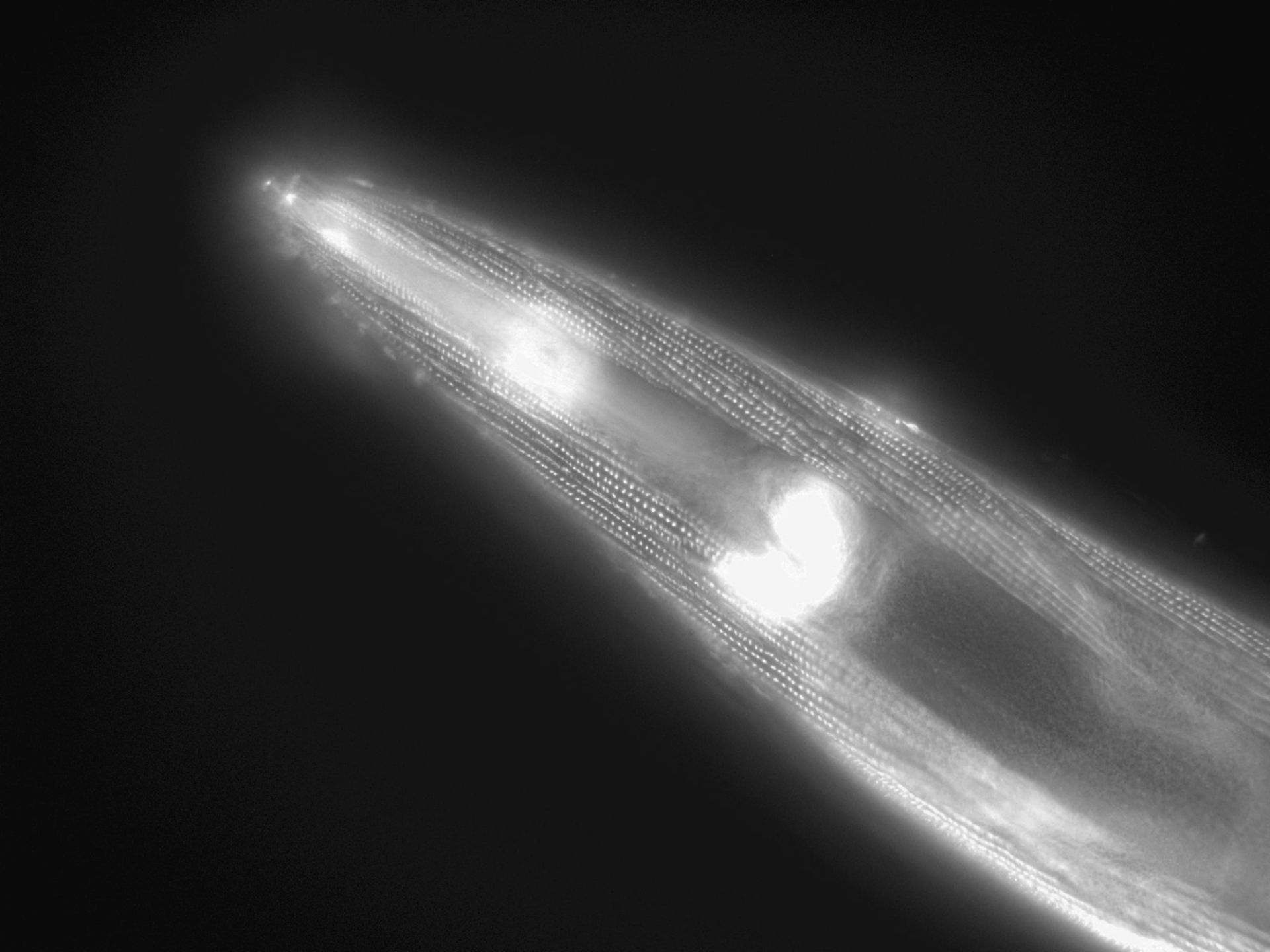 Caenorhabditis elegans (Actin filament) - CIL:1144