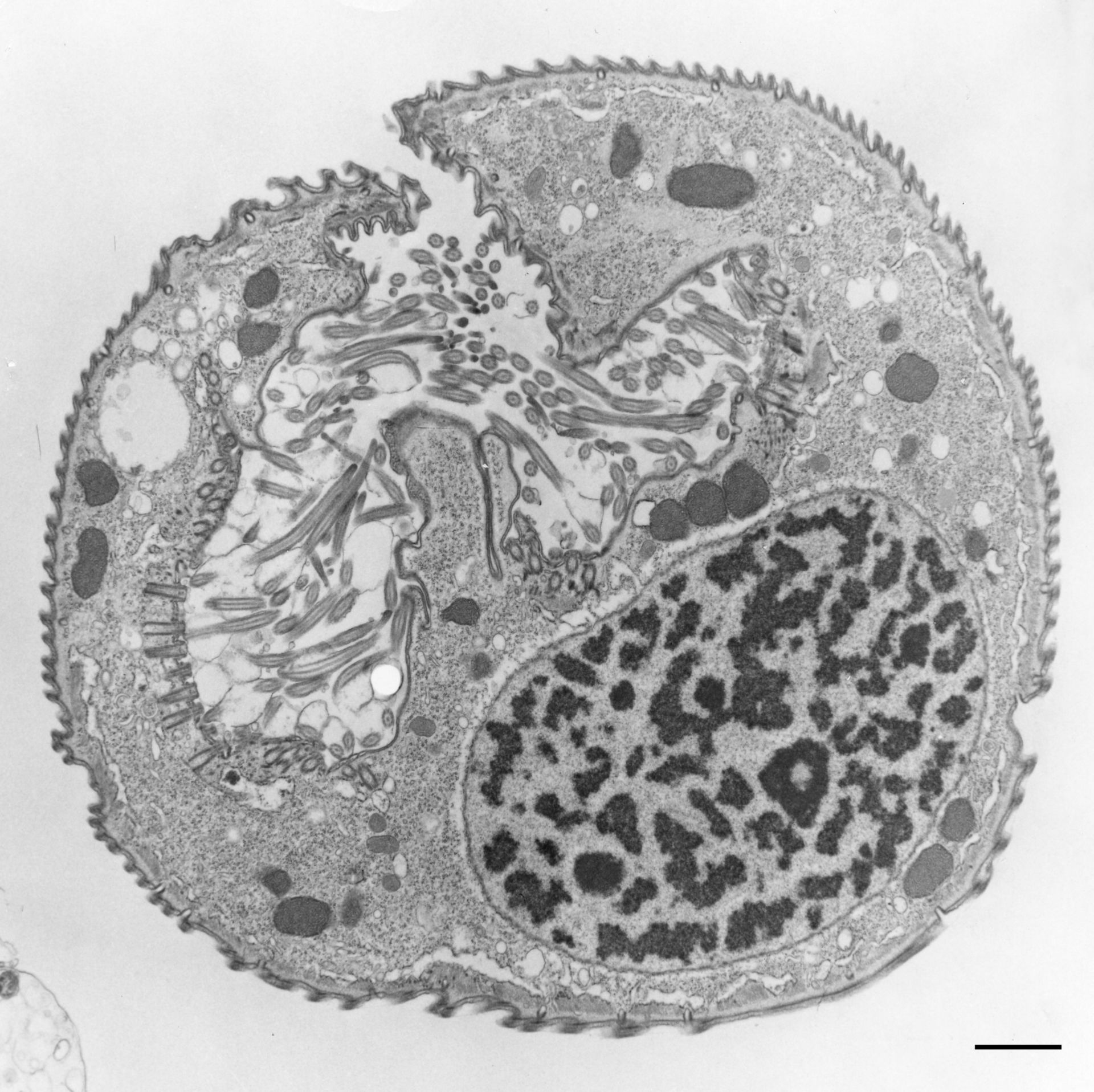 Opercularia coarctata (Cytoplasm) - CIL:9823