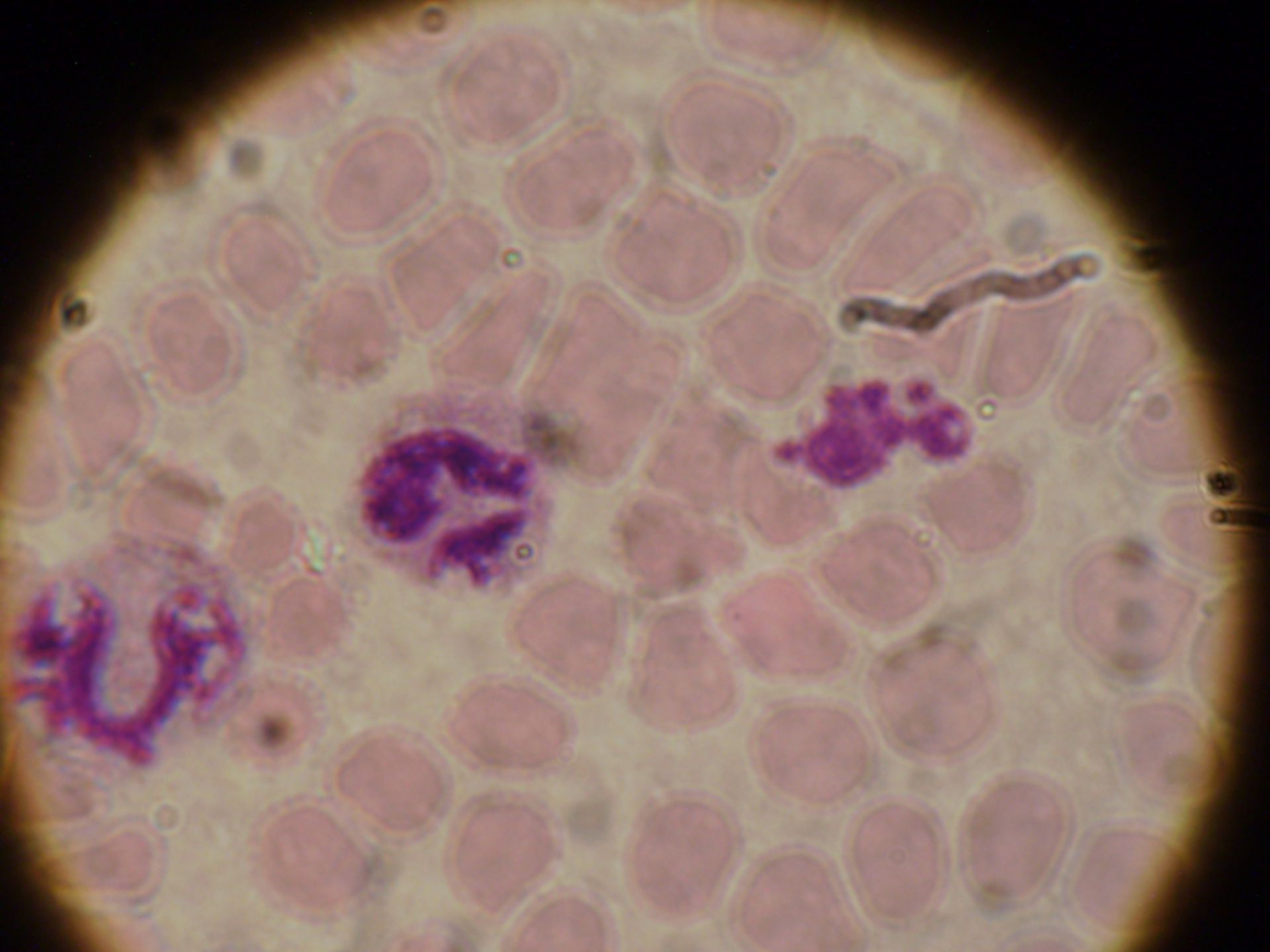 plasmodium ovale schizonth