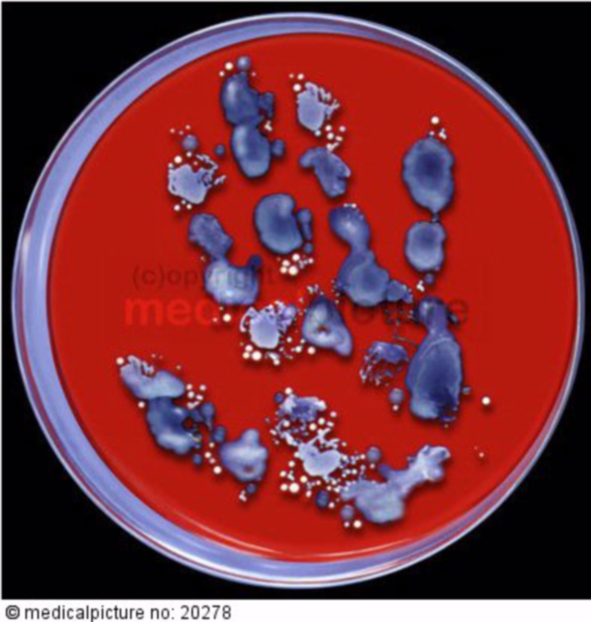  Staphylococcus aureus 