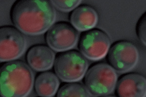 Hefezellen verdauen in Langzeitkulturen ihre Mitochondrien. Dieser Prozess heißt Mitophagie. Proteine, die unterschiedlich schnell verdaut werden, sind fluoreszent markiert. © Jörn Dengjel