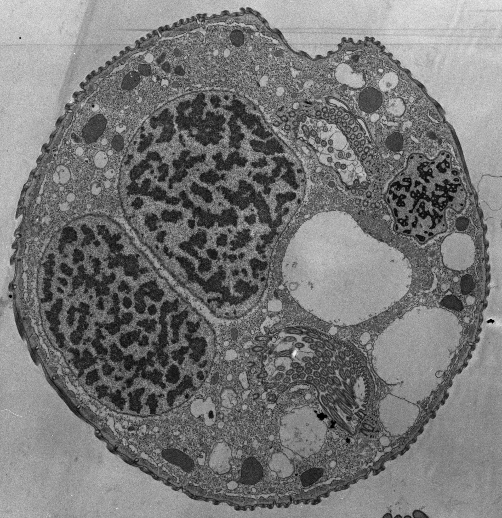 Opercularia coarctata (Micronucleus) - CIL:39173