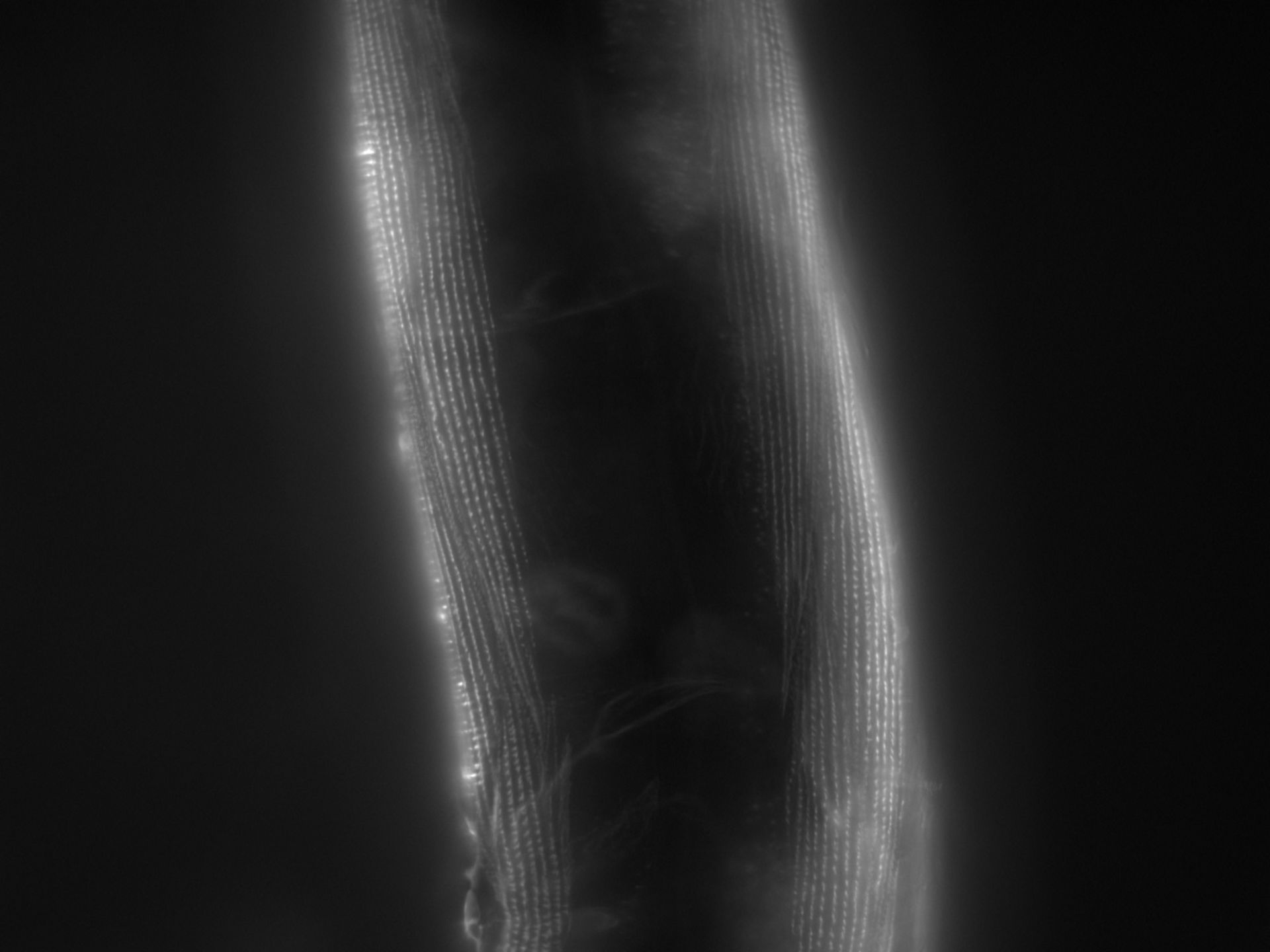 Caenorhabditis elegans (Actin filament) - CIL:1168