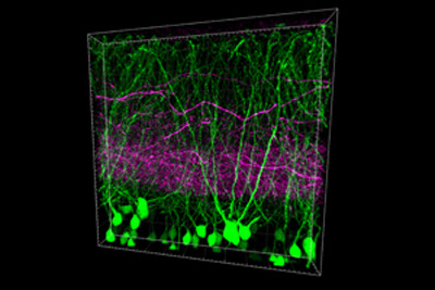 Dreidimensionale Darstellung der Körnerzellen im Hippocampus (grün) und den einlaufenden Fasern der Großhirnrinde (magenta) mit Hilfe fluoreszierender Farbstoffe. © Cerebral Cortex / Oxford University Press 