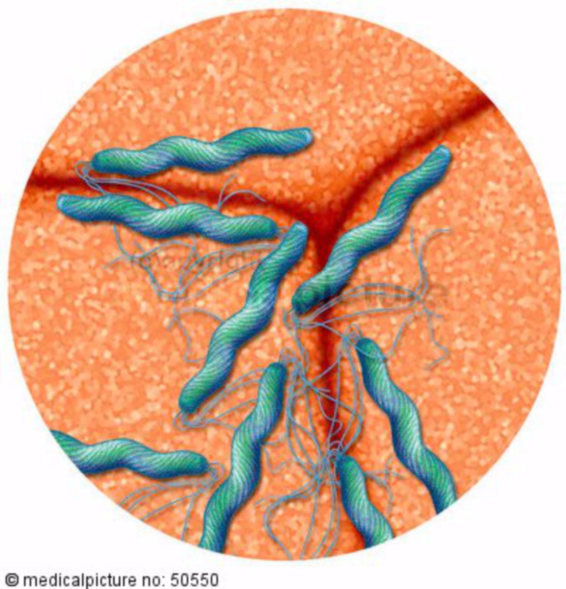 Helicobacter pylori auf Magenschleimhaut