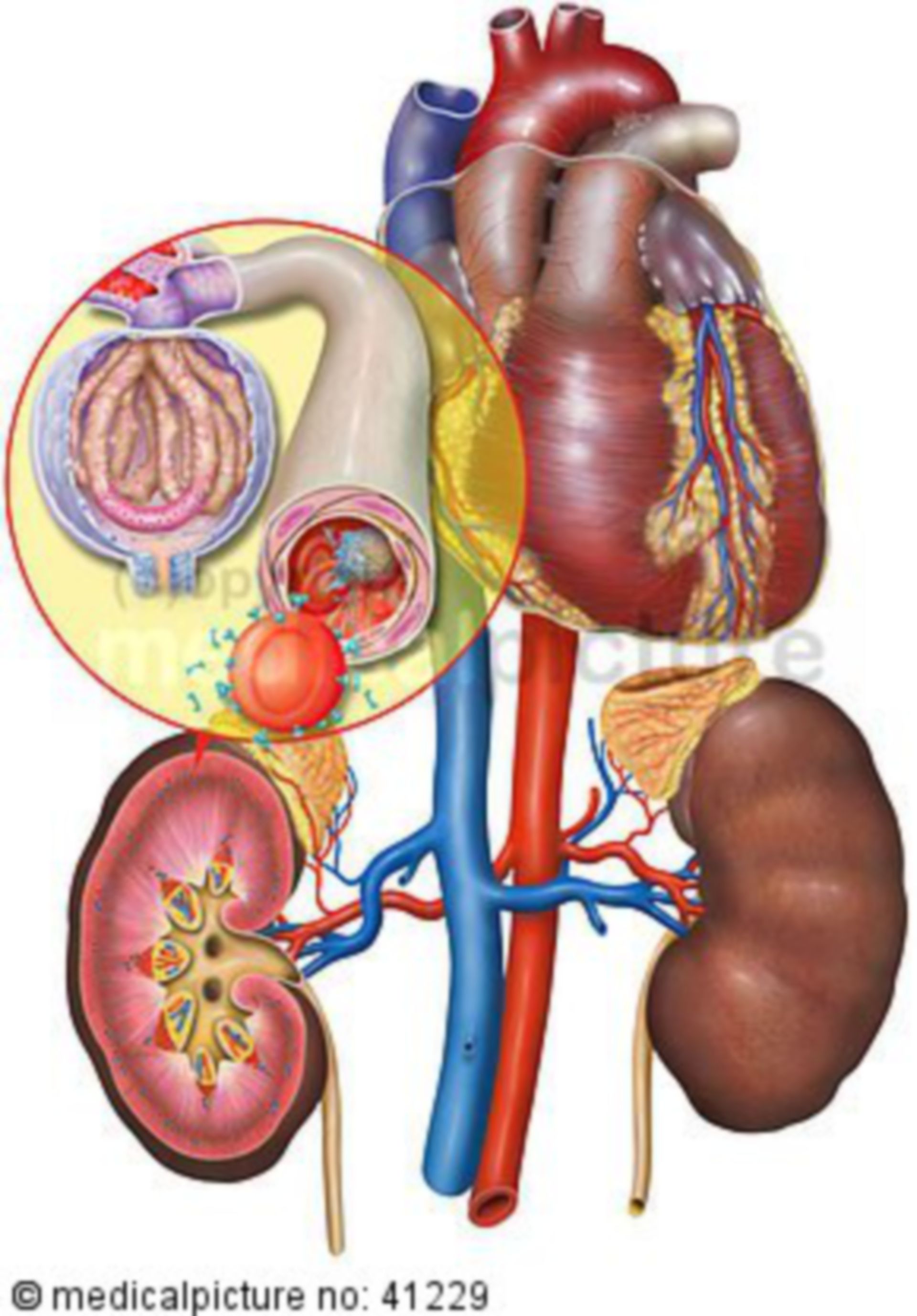 Harnwegsinfekt und Entzündung, urinary tract infection, sepsis