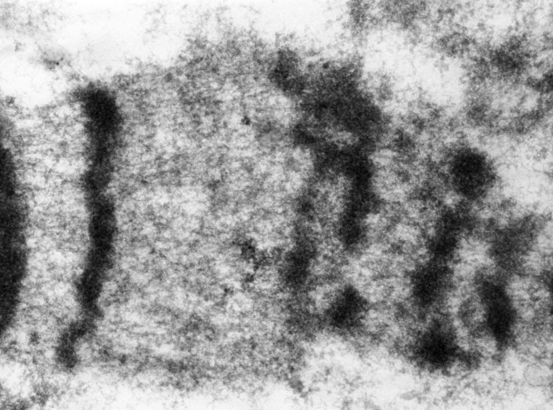 Drosophila melanogaster (Polytene chromosome) - CIL:24969