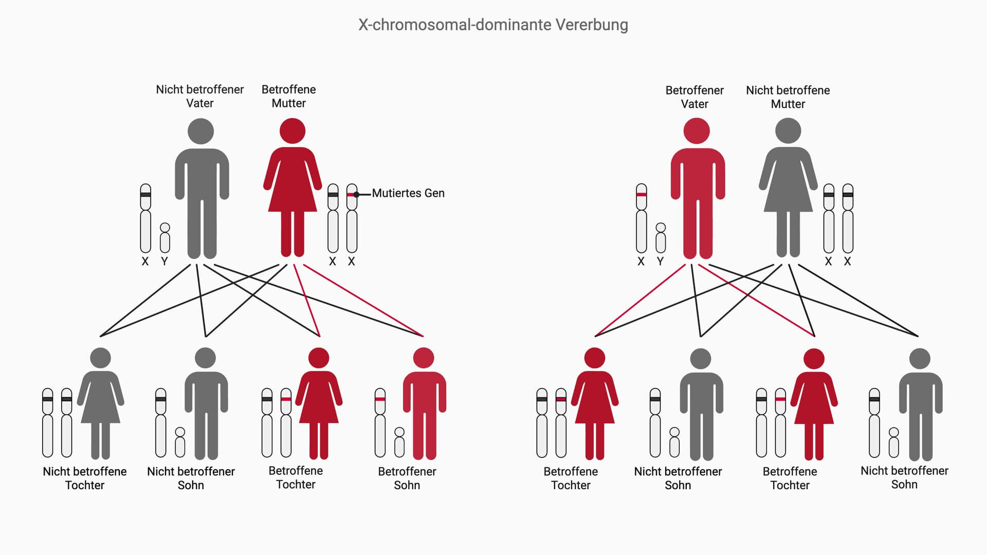 X-chromosomal-dominanter Erbgang