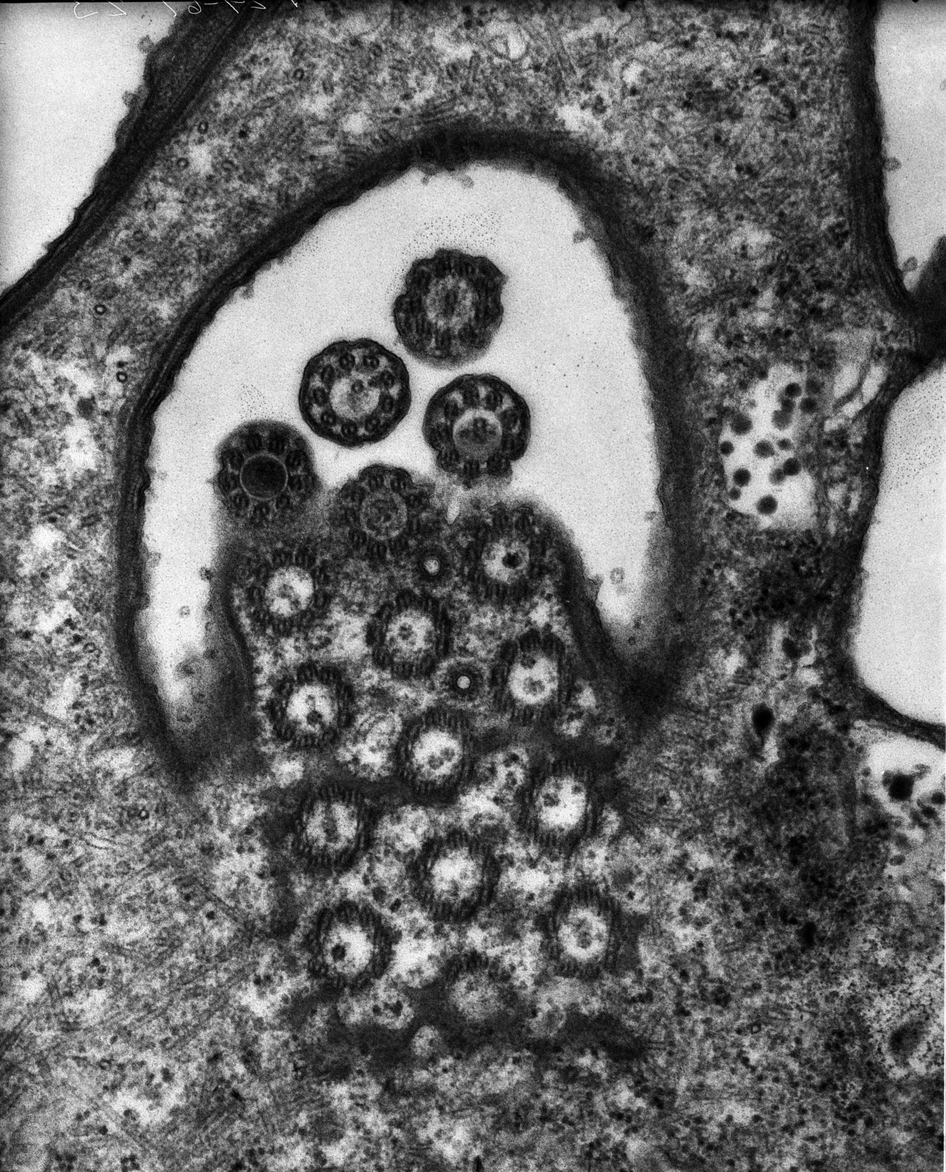 Euplotes sp. (Clathrin adaptor complex) - CIL:9706