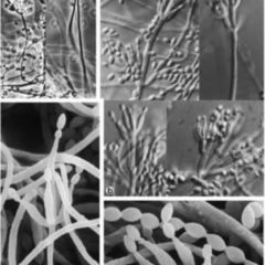 Mykologie DocCheck Flexikon