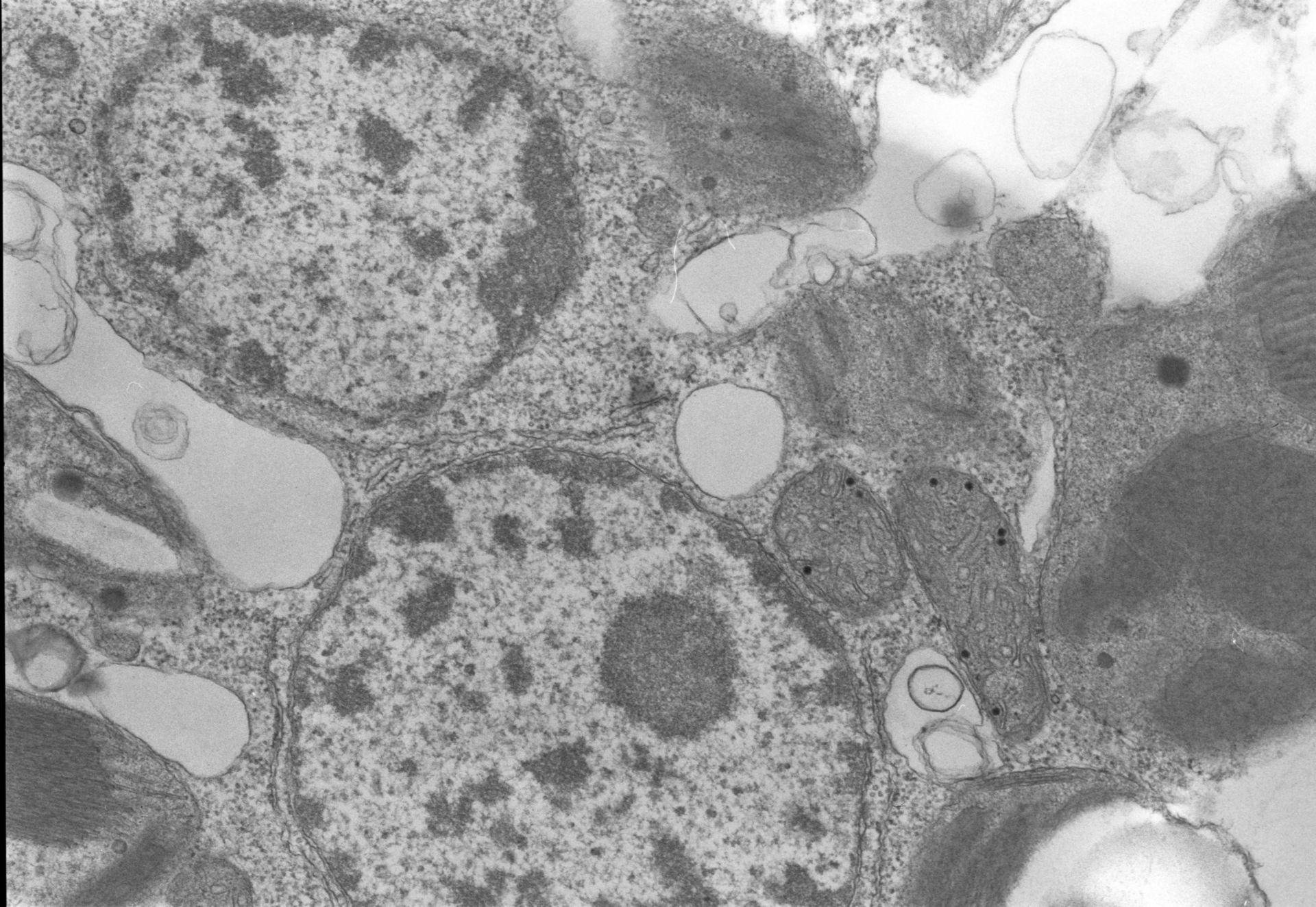 Acetabularia mediterranea (Chloroplast starch grain) - CIL:558