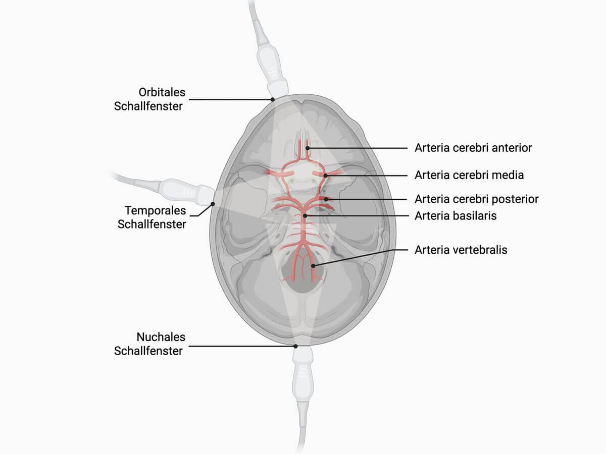 Transkranielle Sonographie: Schallfenster