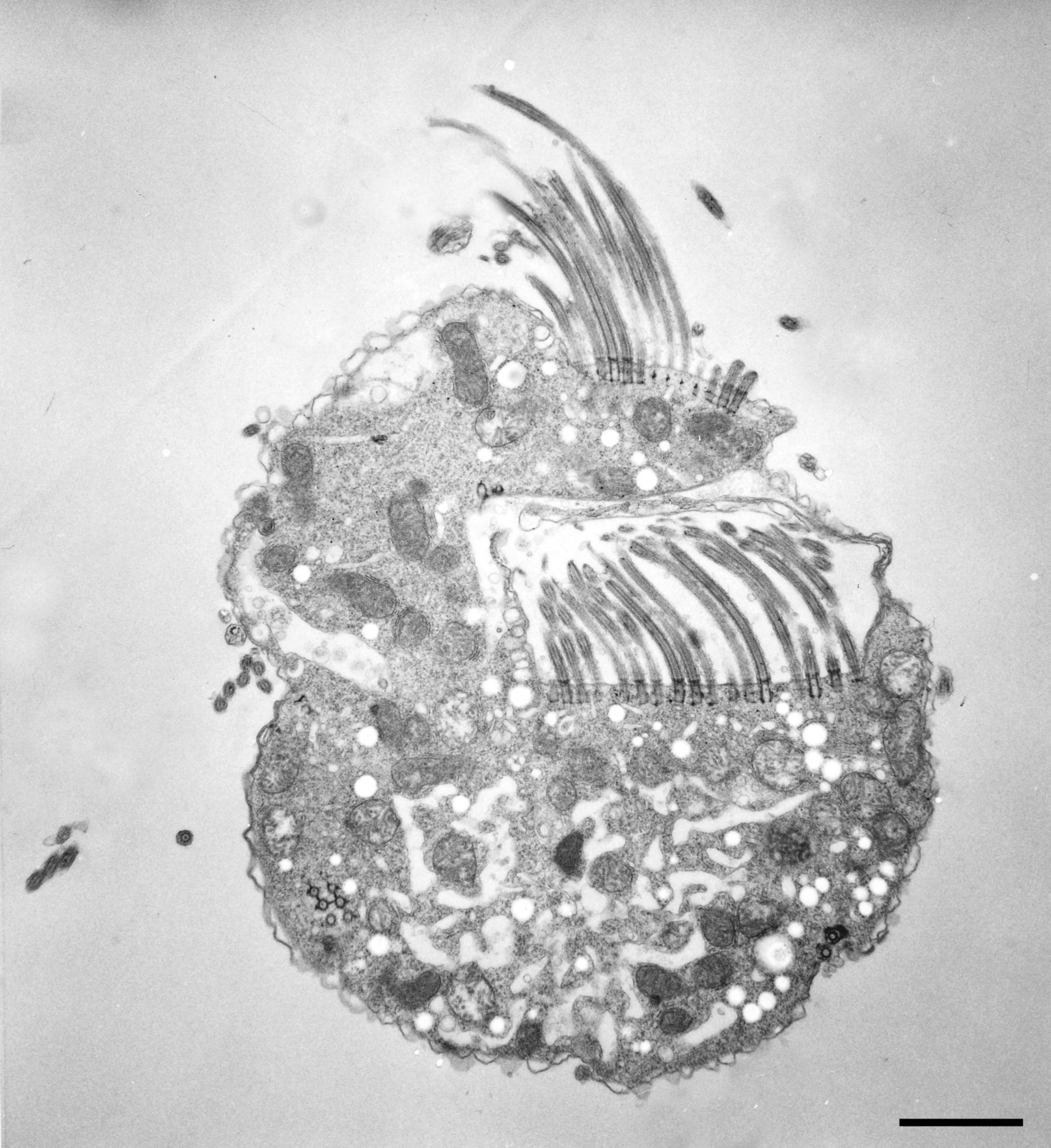 Halteria grandinella (Cytoplasm) - CIL:12320