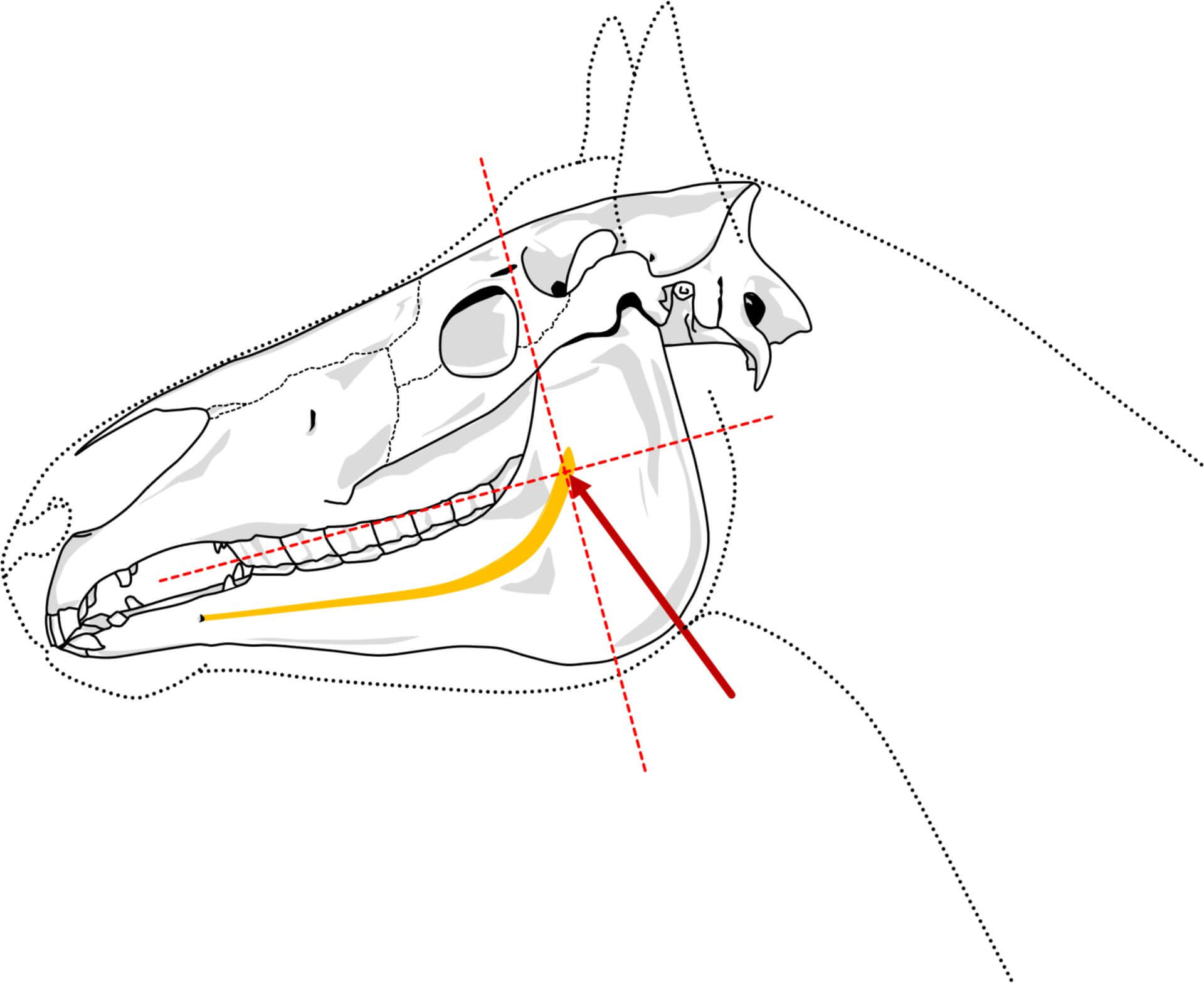 Foramen-mandibulae-Anästhesie (© Patrick Messner)