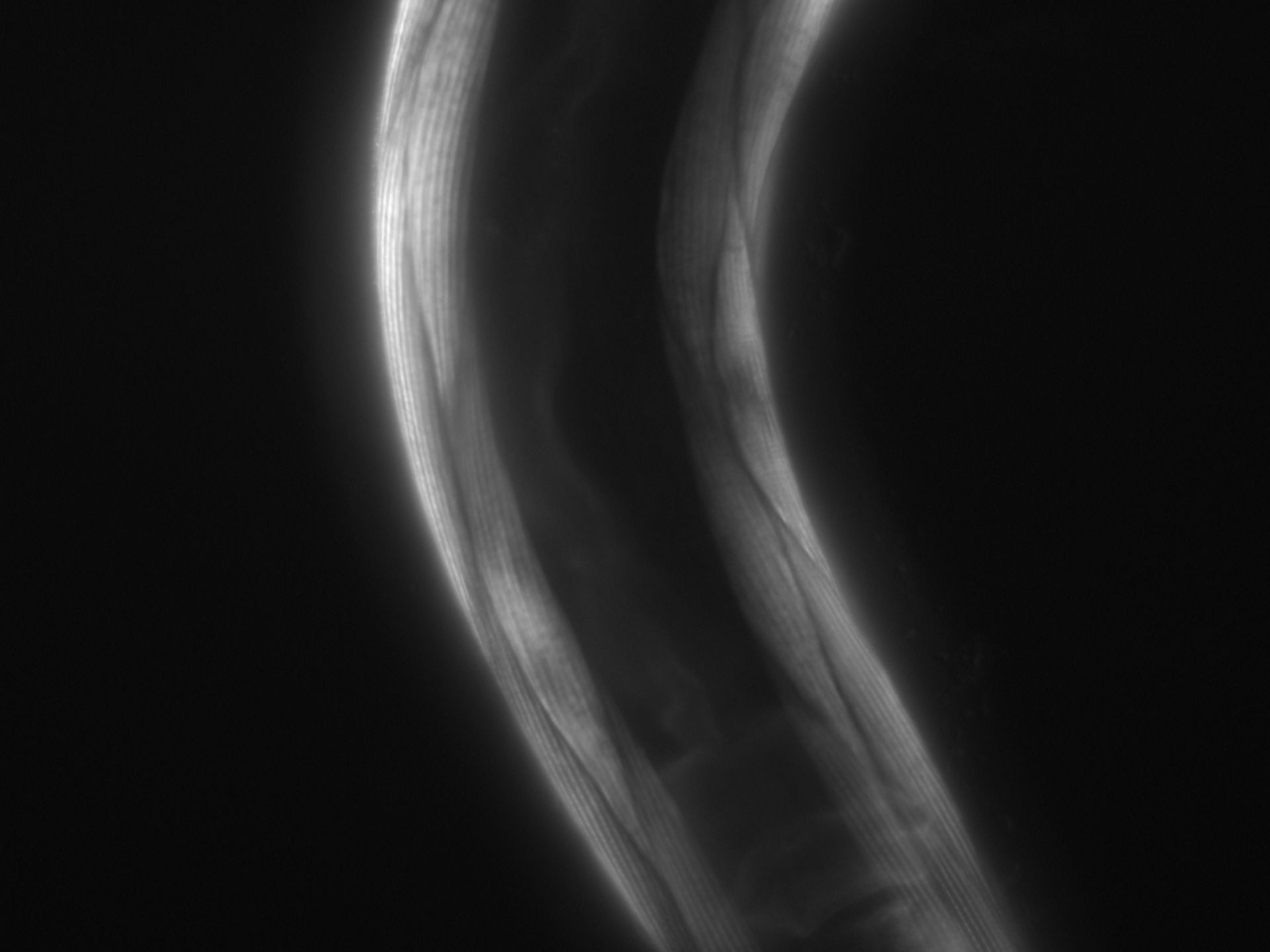 Caenorhabditis elegans (Actin filament) - CIL:1069