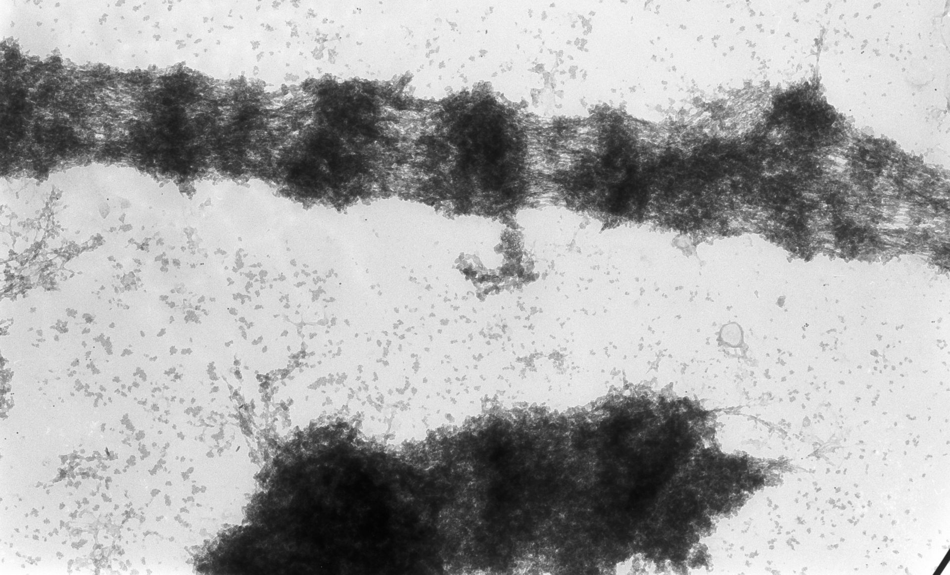 Drosophila melanogaster (Polytene chromosome) - CIL:25308