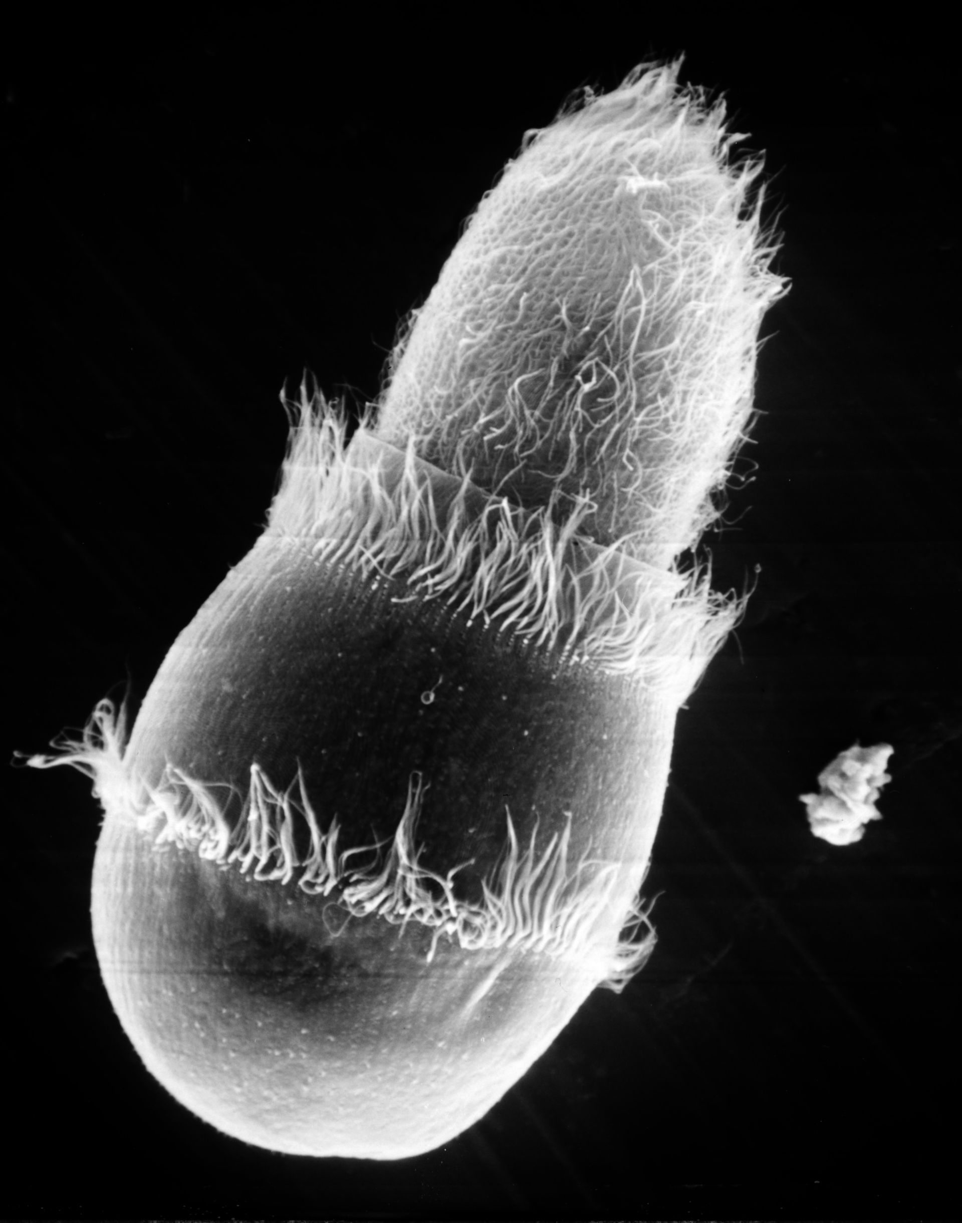 Paramecium sp. (Cell surface) - CIL:39246