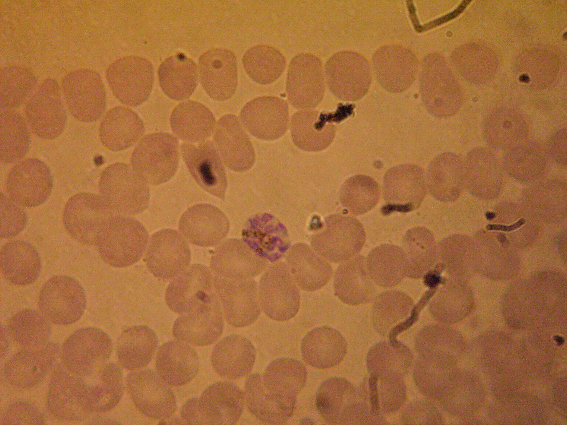 Plasmodium malariae (b)