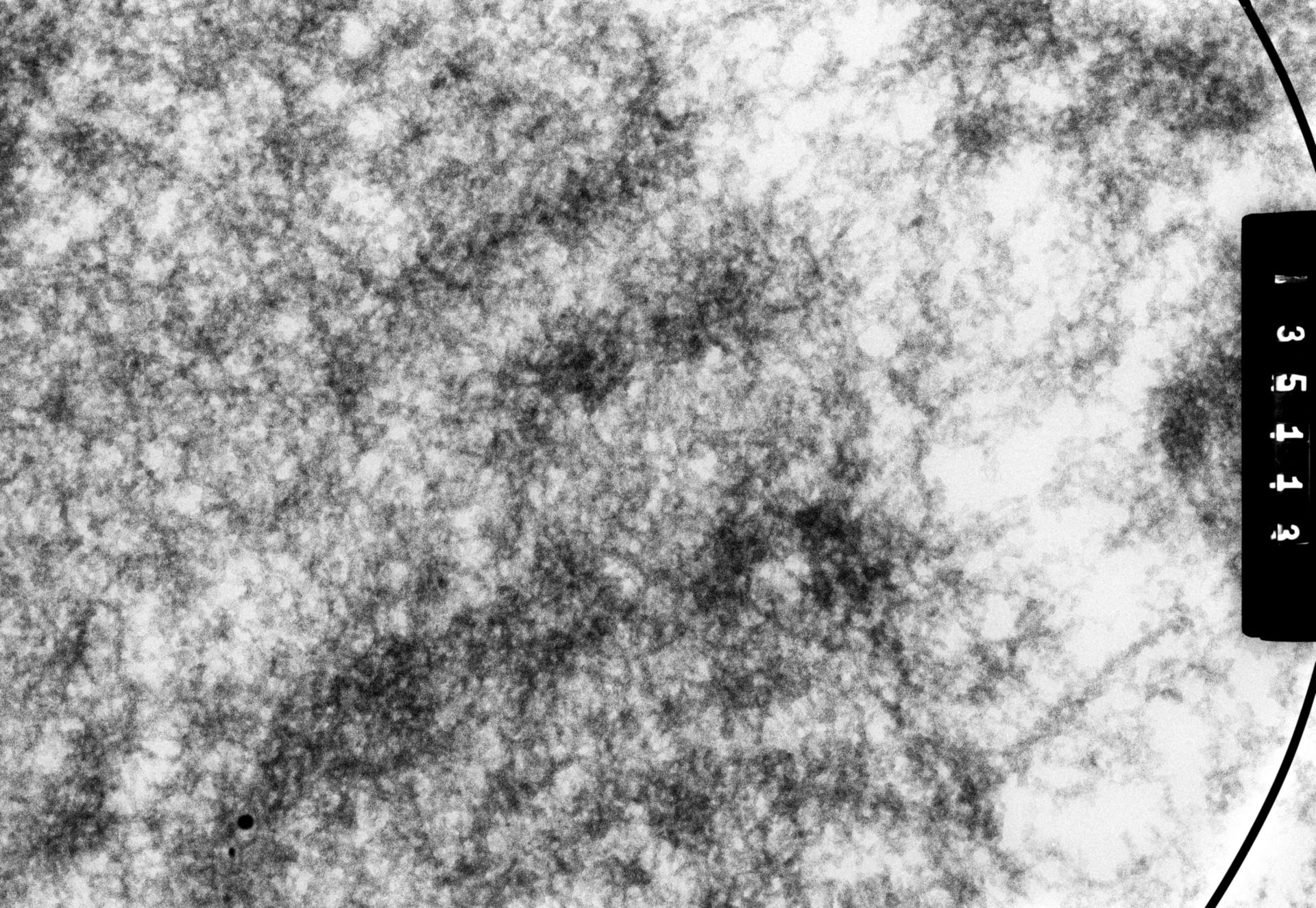 Drosophila melanogaster (Polytene chromosome) - CIL:25324