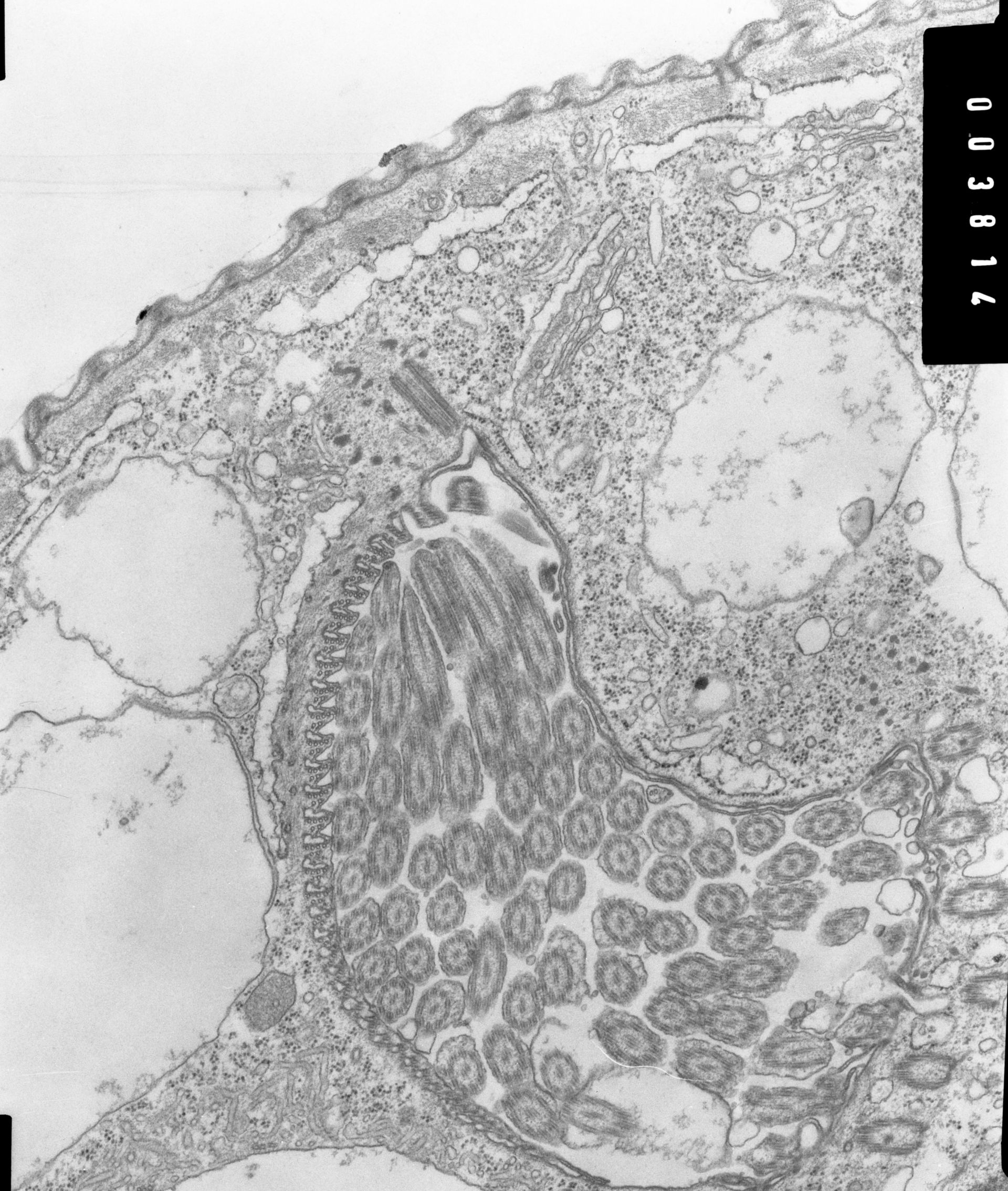 Opercularia coarctata (Microtubule basal body) - CIL:7335