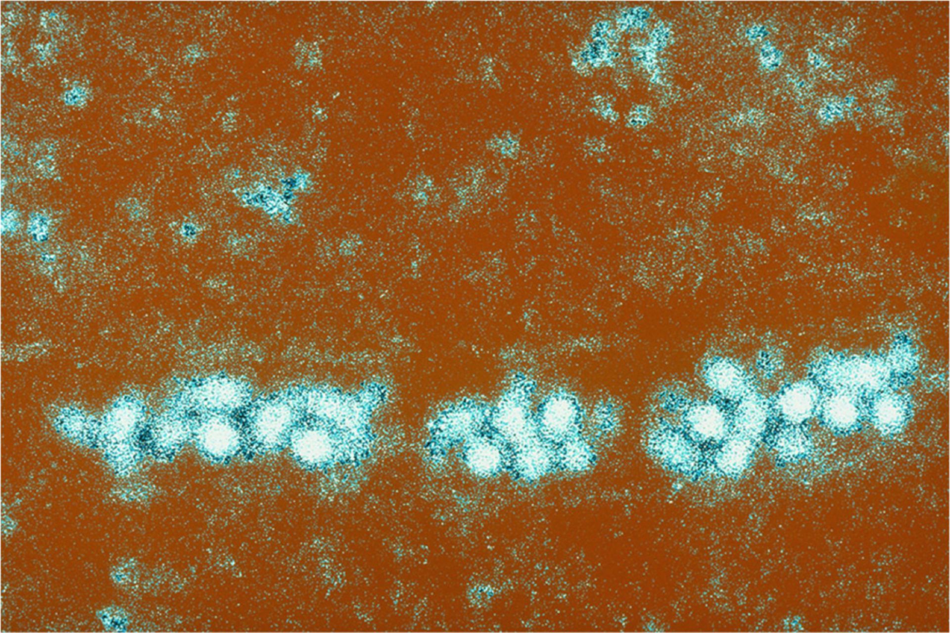 Gelbfiebervirus