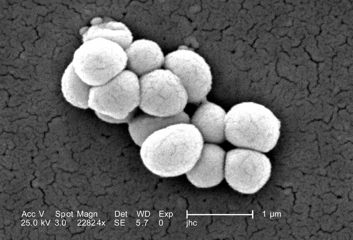Micrococcus luteus