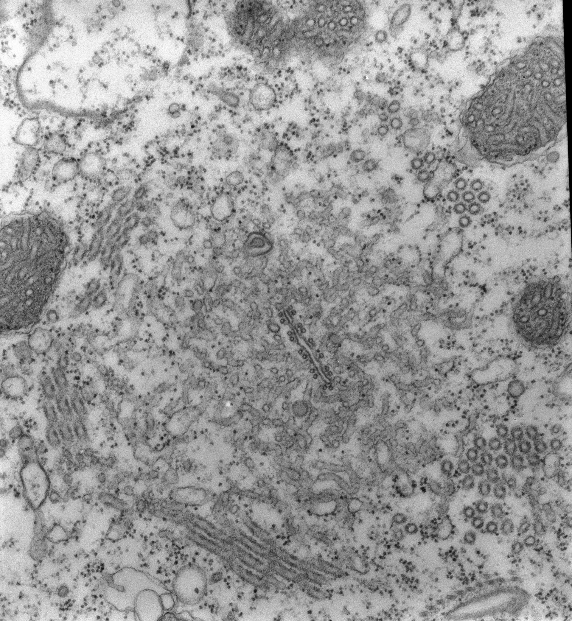 Paramecium multimicronucleatum (Cytoplasm) - CIL:13096