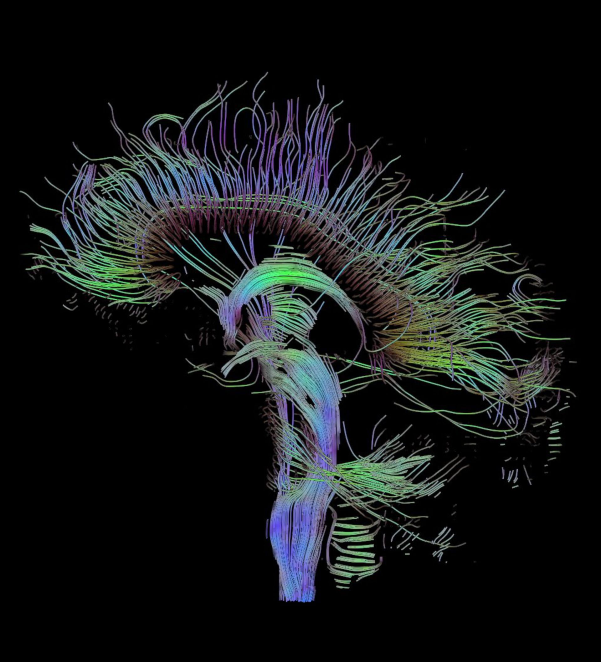 Tractographic reconstruction of neural connections via DTI