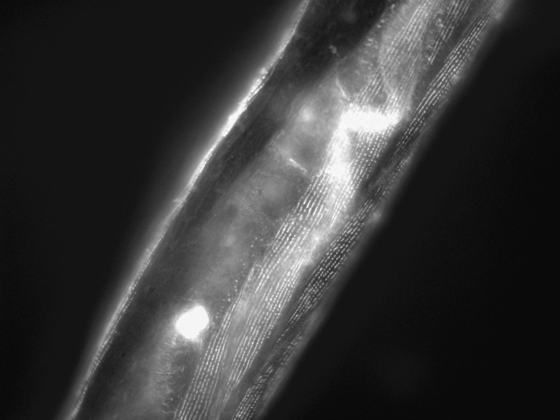 Caenorhabditis elegans (Actin filament) - CIL:1149