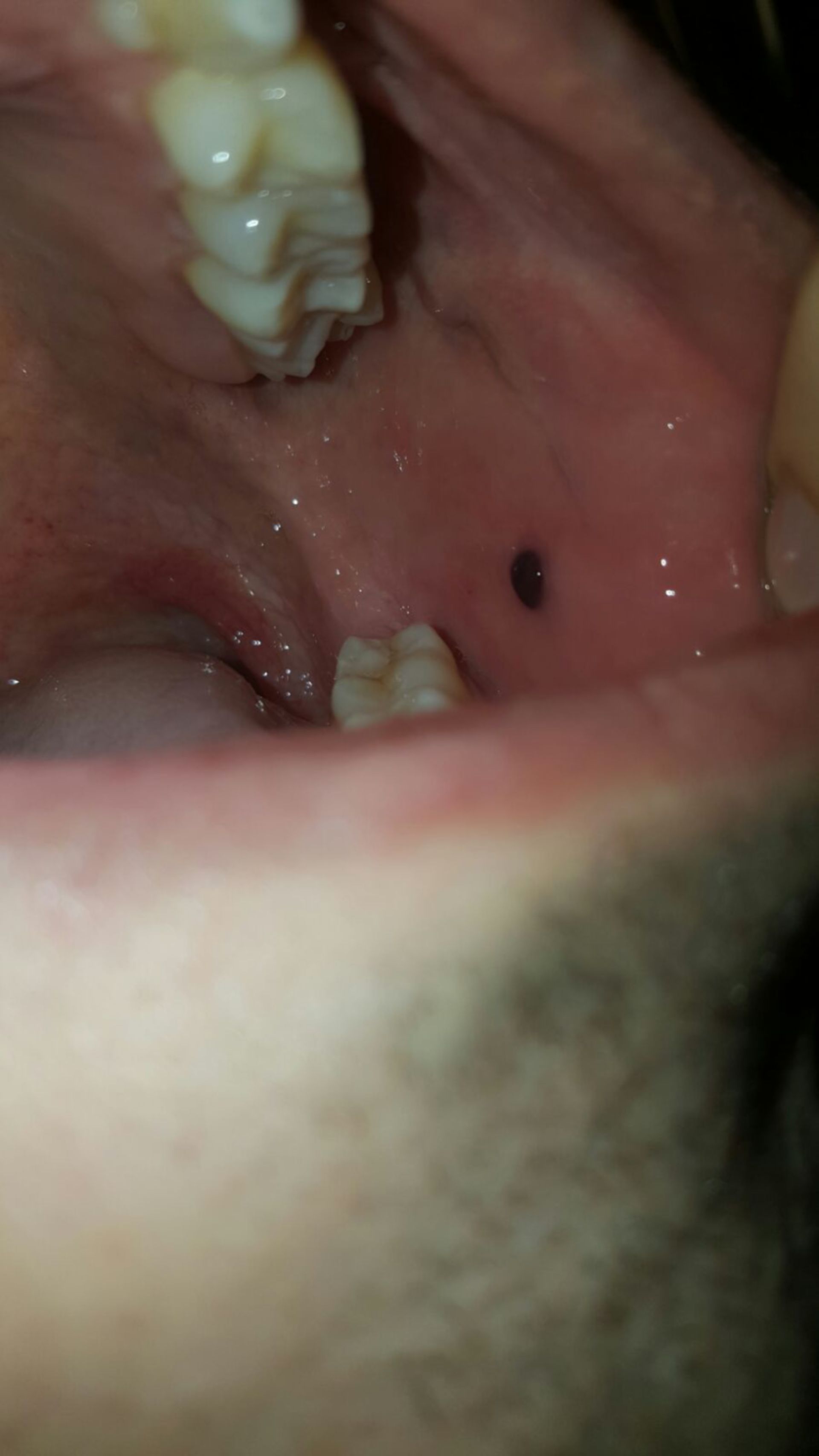 Aufnahme der Mundhöhle