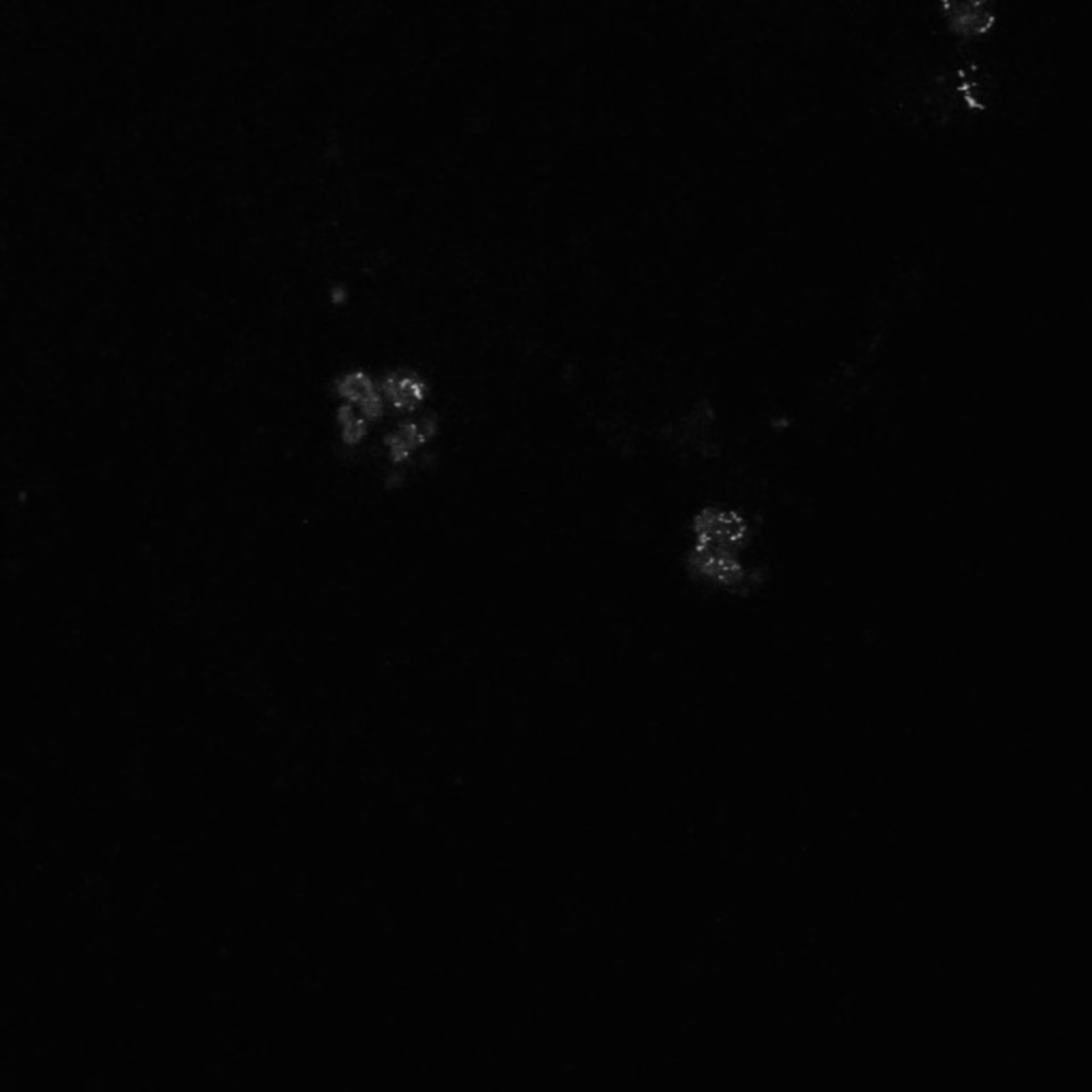 Xenopus laevis (Neuronal cell body) - CIL:37013