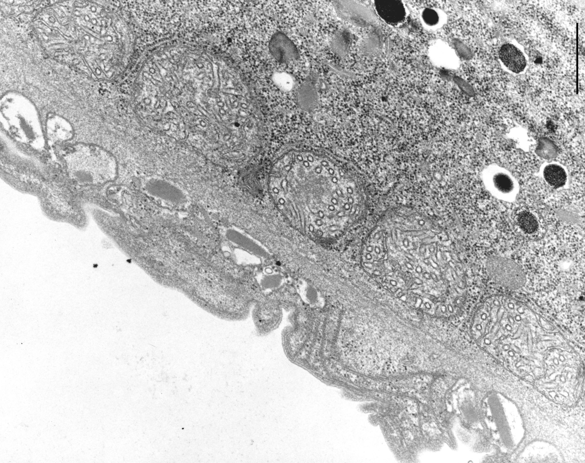 Didinium nasutum (Extrusomes) - CIL:10005