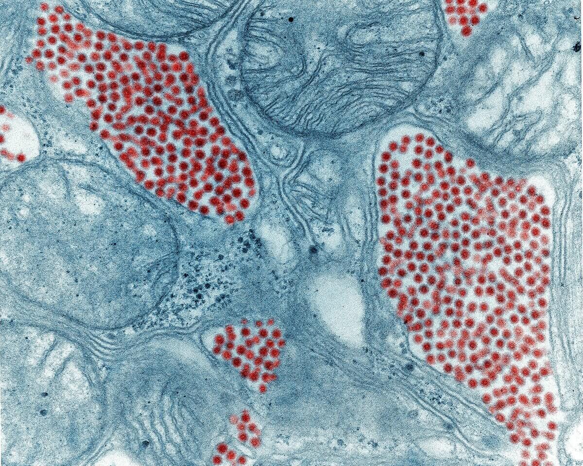 Eastern-Equine-Encephalomyelitis-Virus