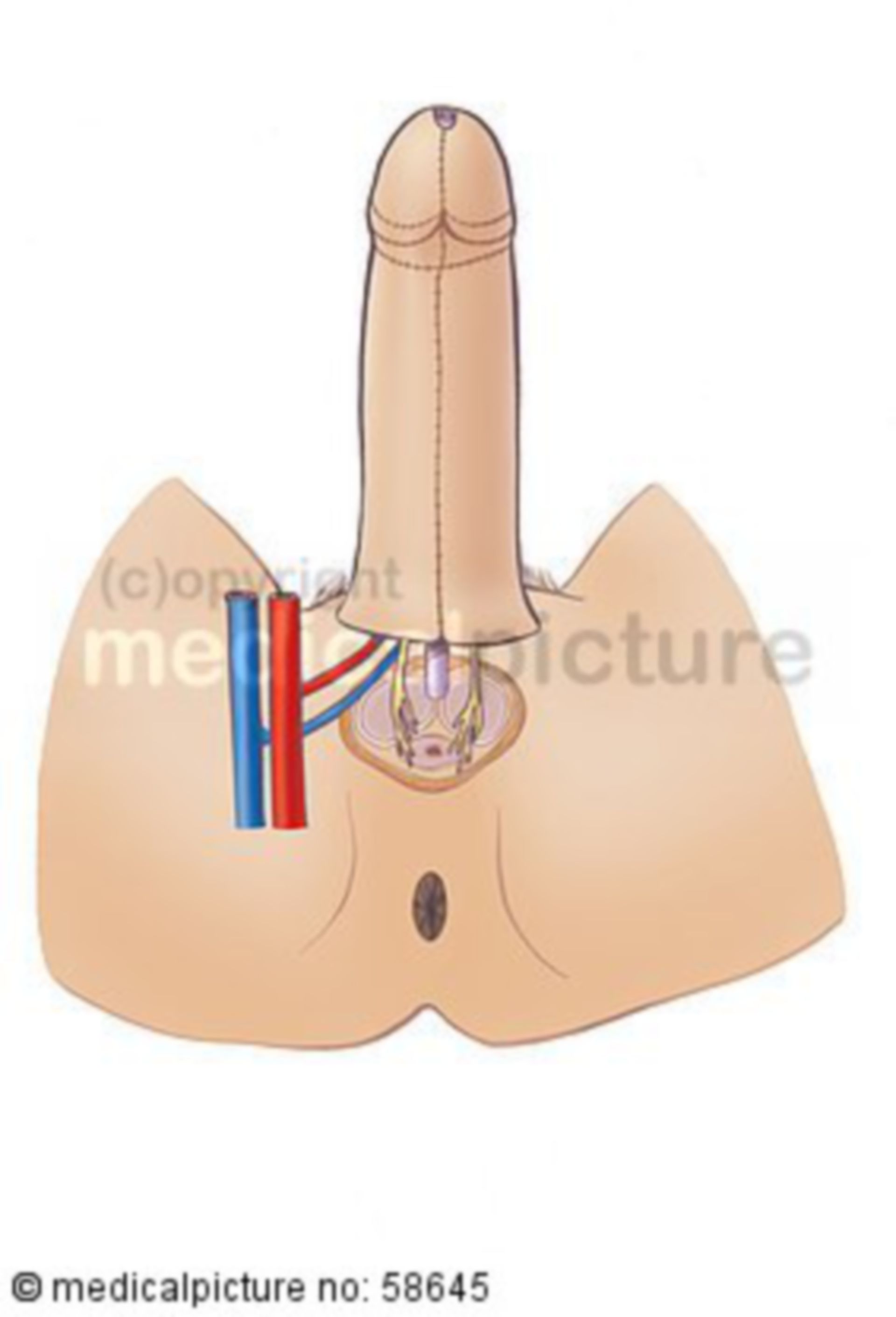 Penis-(re)construction (attachment to male anatomy)