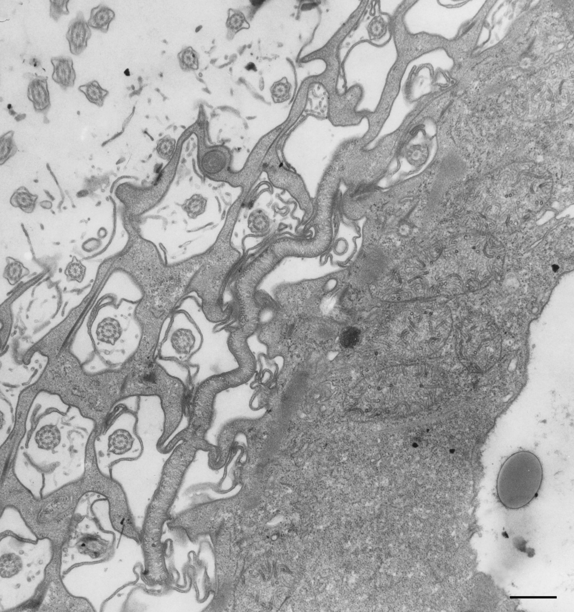 Paramecium multimicronucleatum (Cytoplasm) - CIL:13131