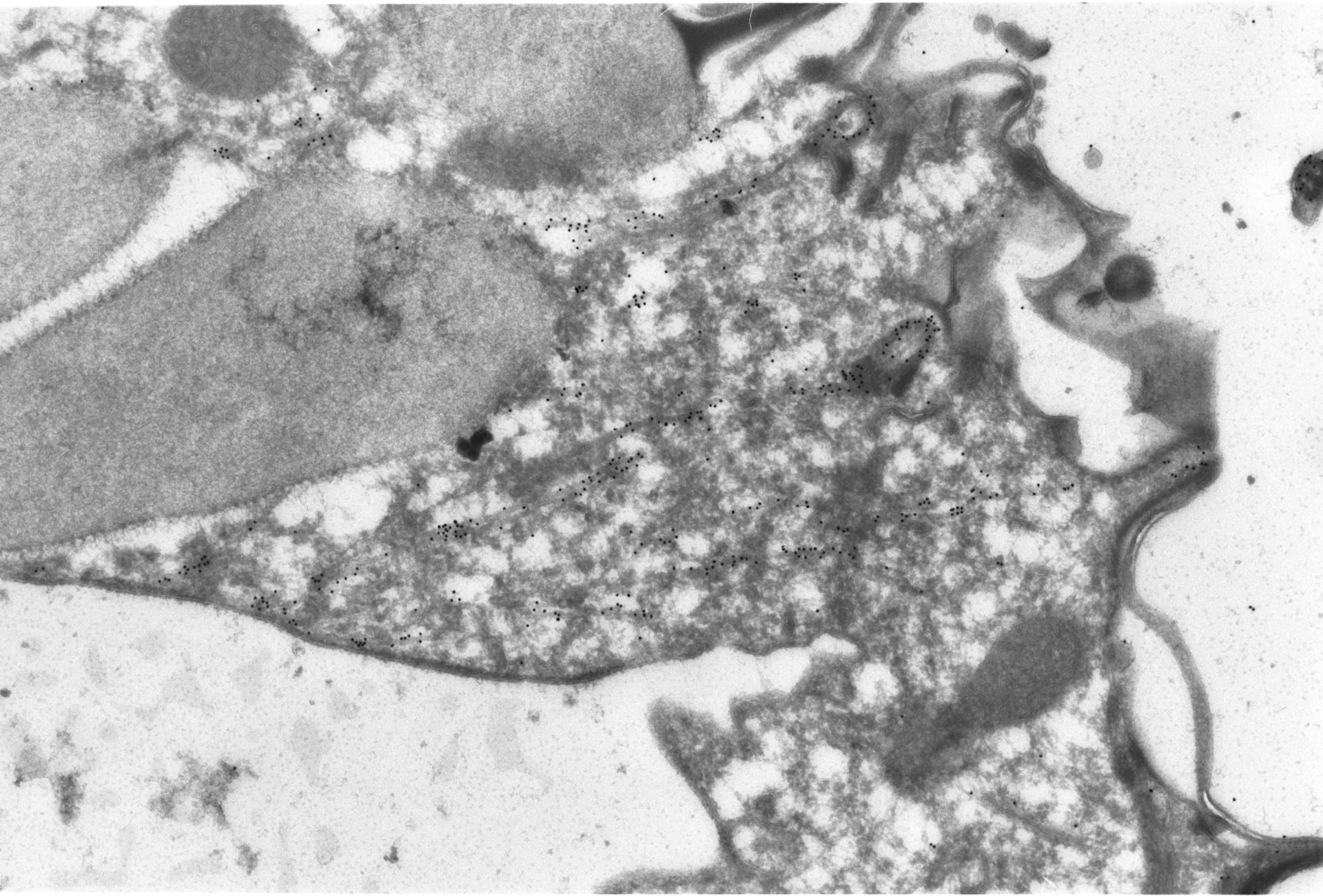 Paramecium tetraurelia (Axonemal microtubule) - CIL:1307