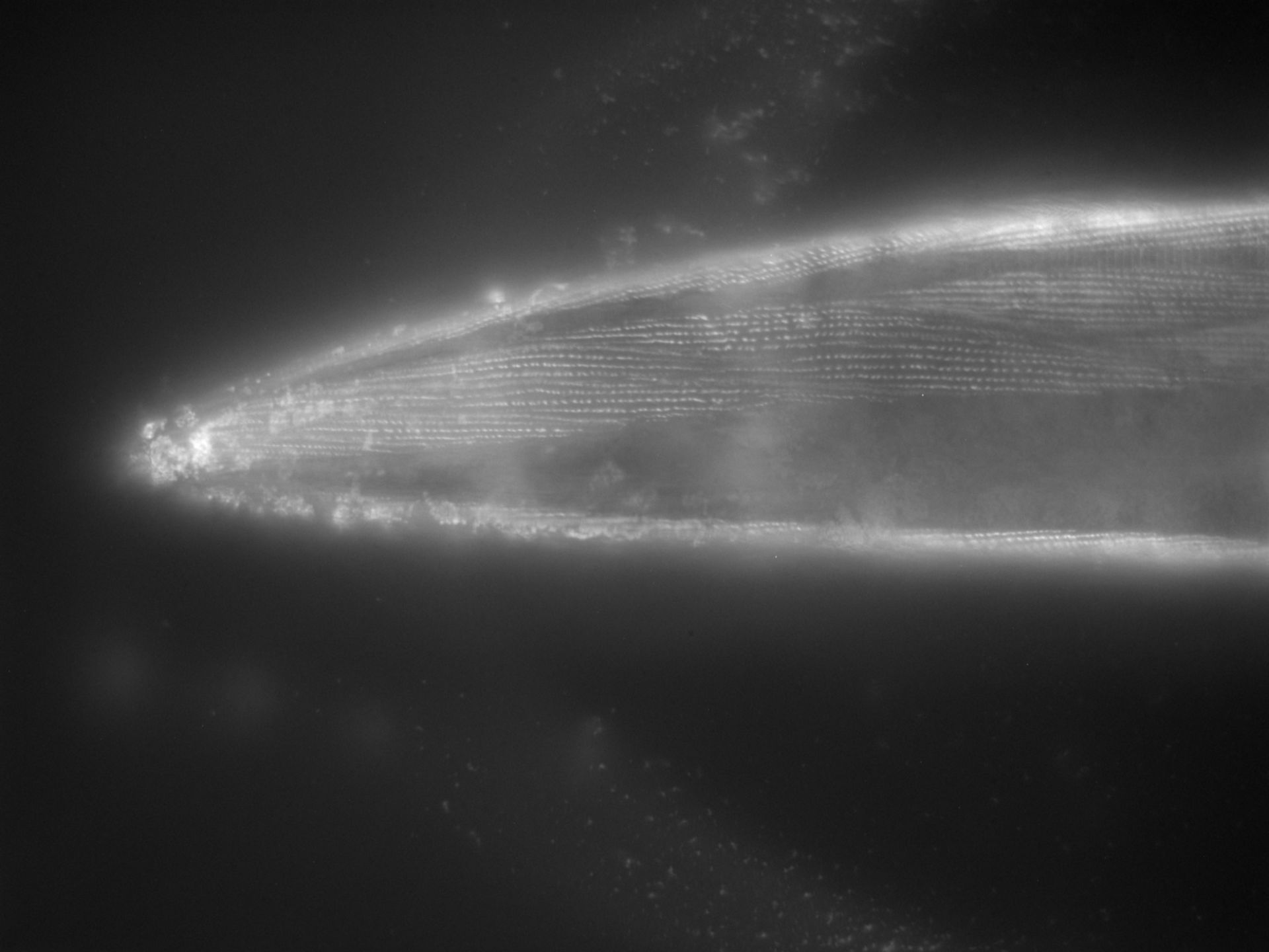 Caenorhabditis elegans (Actin filament) - CIL:1108