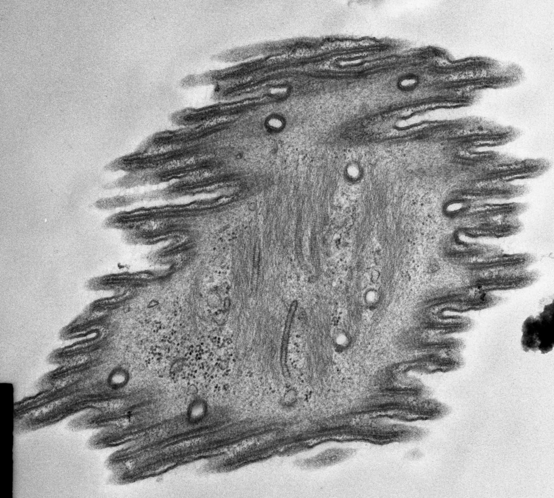 Opercularia coarctata (Clathrin vesicle coat) - CIL:7343