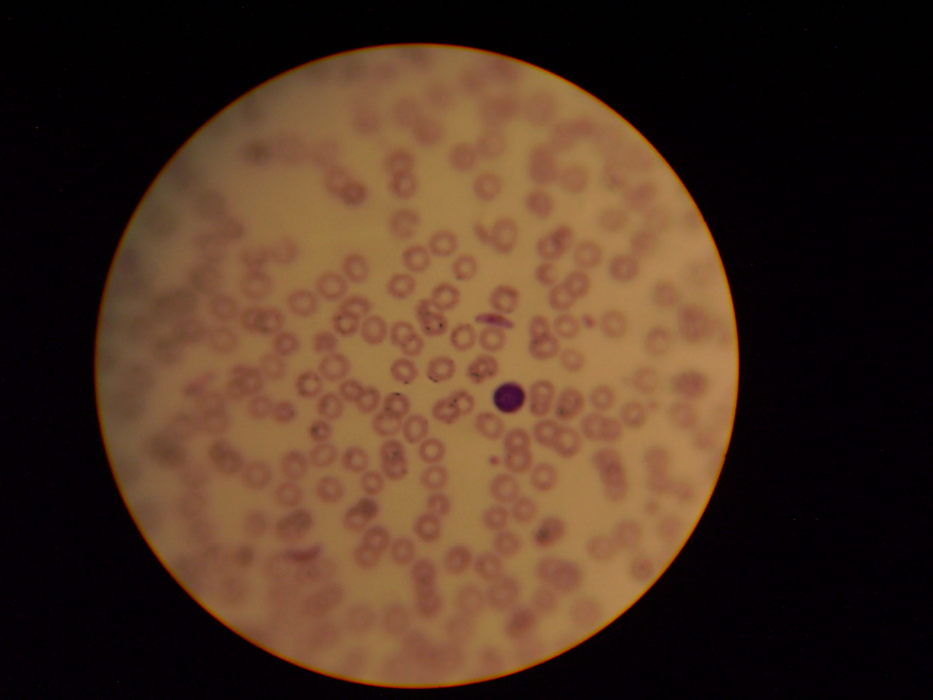 Plasmodium falciforme gametociti