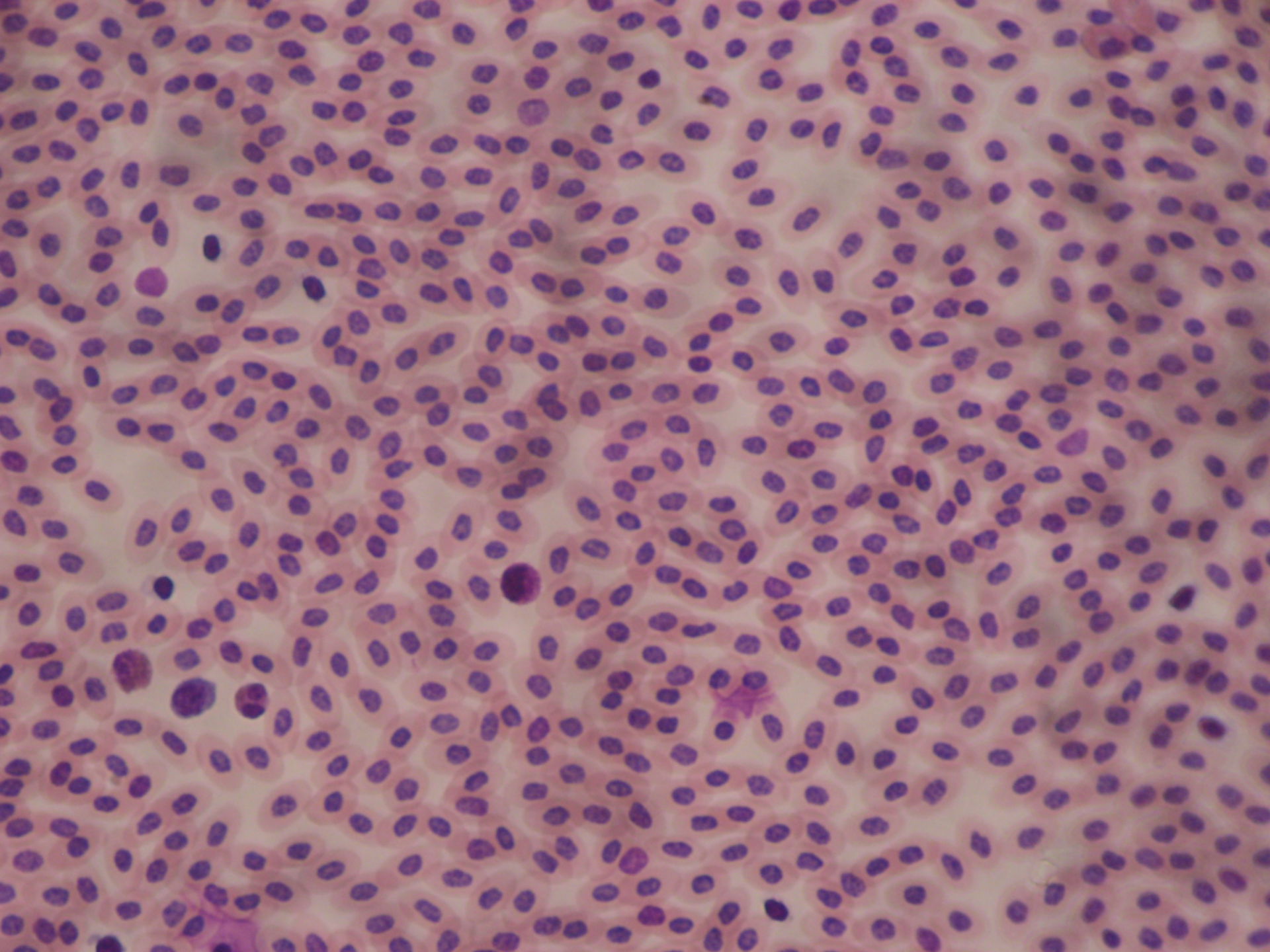 Blutausstrich des Huhnes 3 - Pseudoeosinophiler Granulozyt, Lymphozyt, Eosinophiler Granulozyt, Basophiler Granulozyt