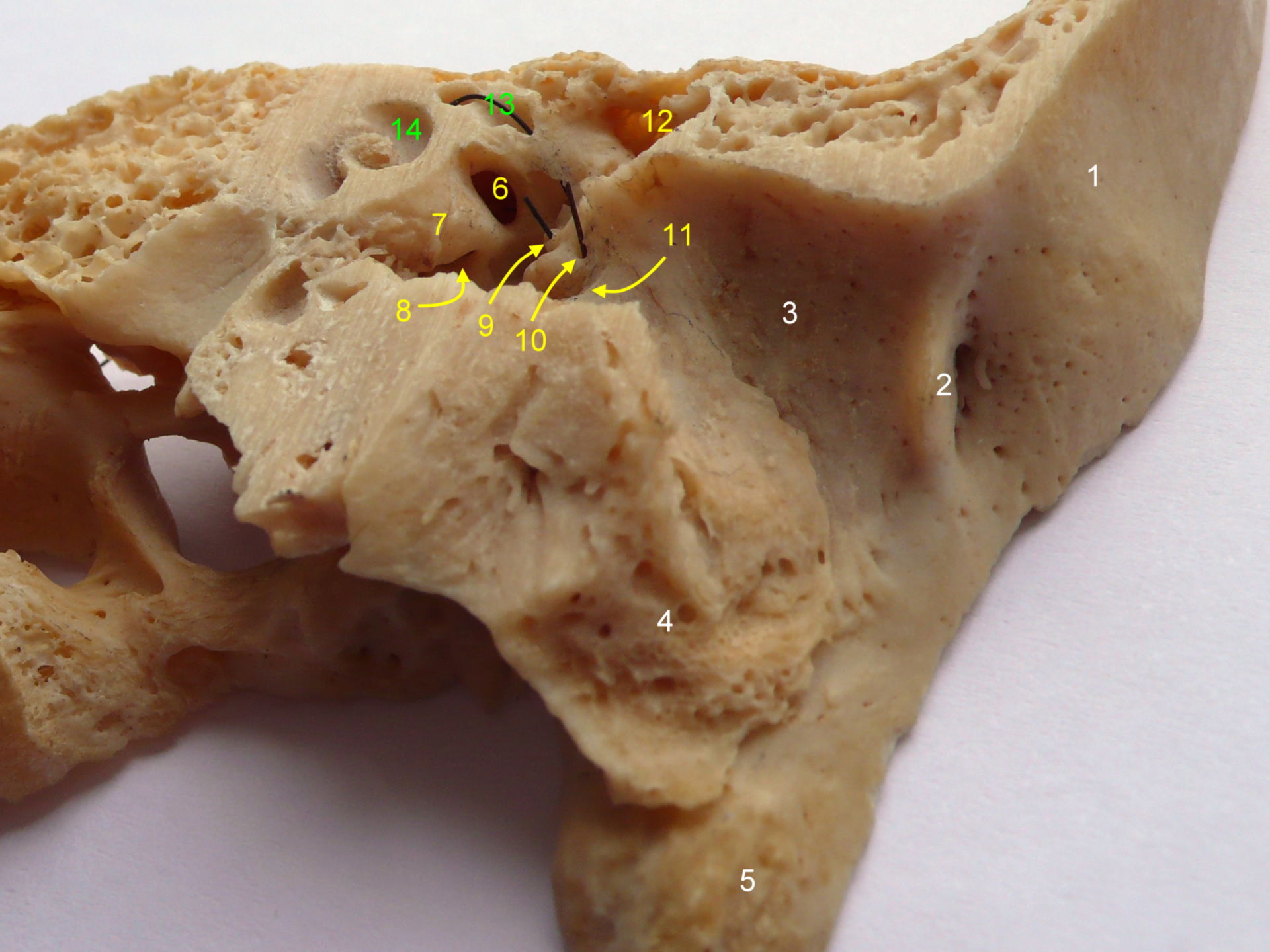 Section through the temporal bone